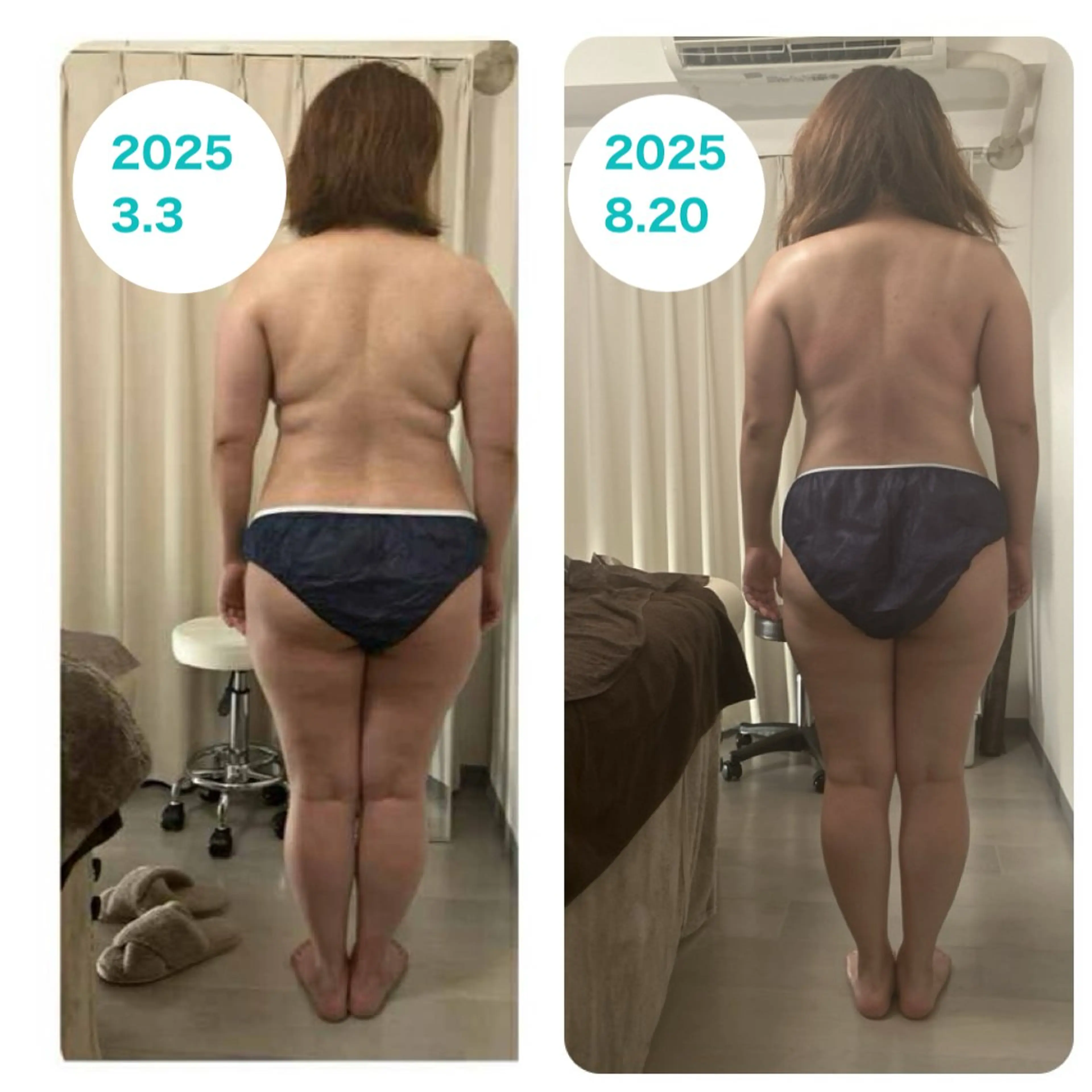 🔥目指せ痩せ体質🔥​〜​ダイエット6回コース​〜​全身オールハンドトリートメント80分！施術💪🏻（初回のみ60分）の写真