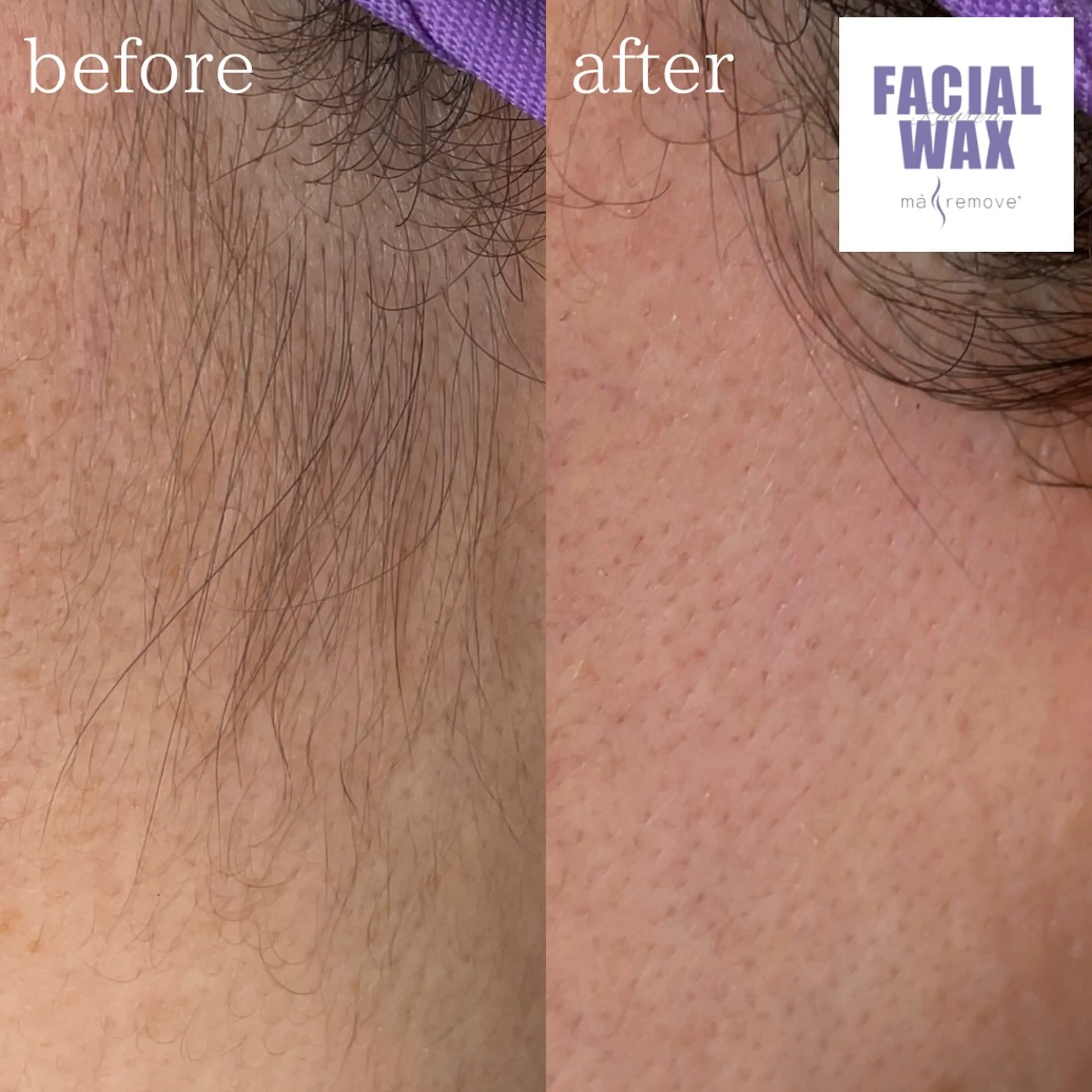 Raure'a Yurikoのマツエク・マツパデザイン