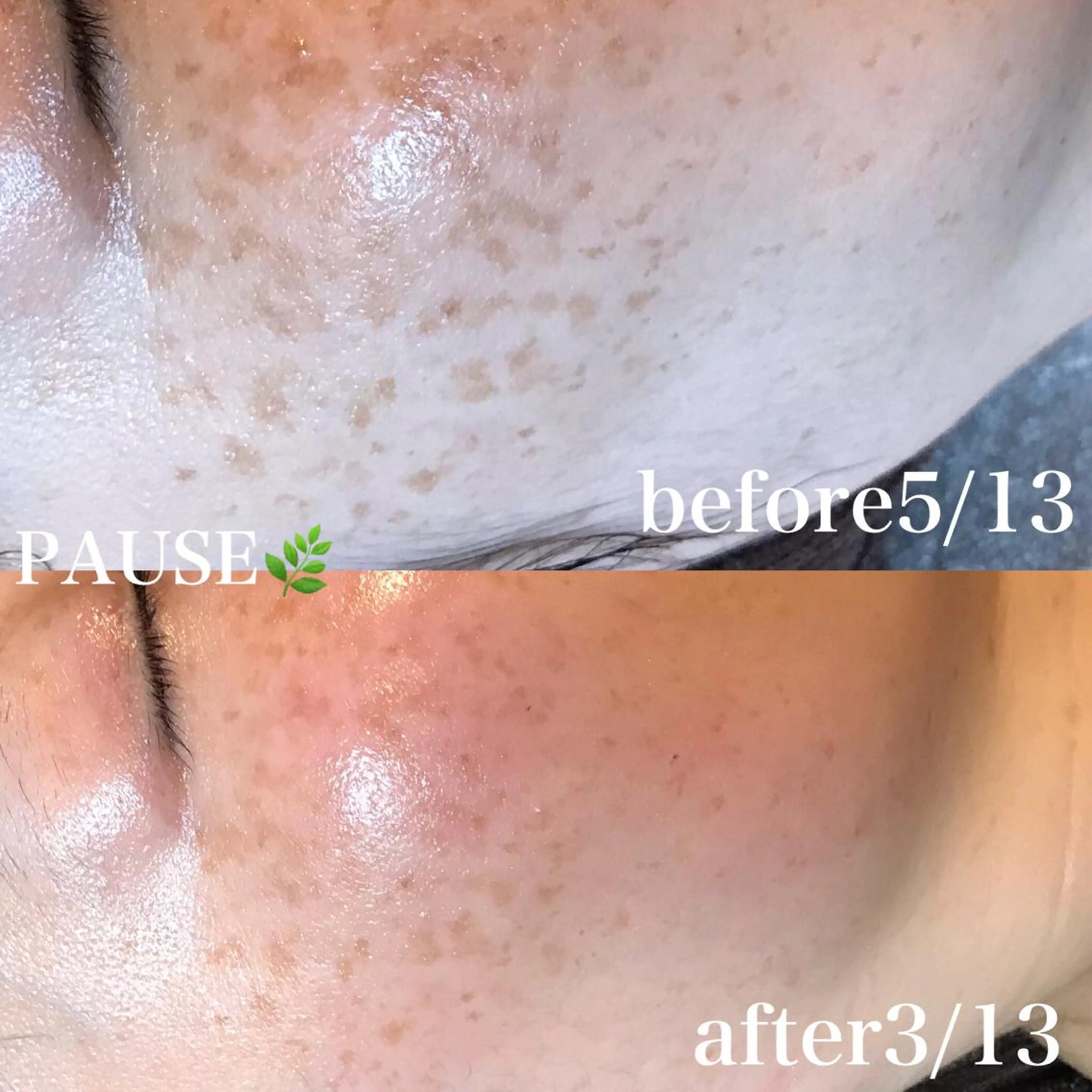 エステ 浜野 恵美のエステ・リラクイメージ