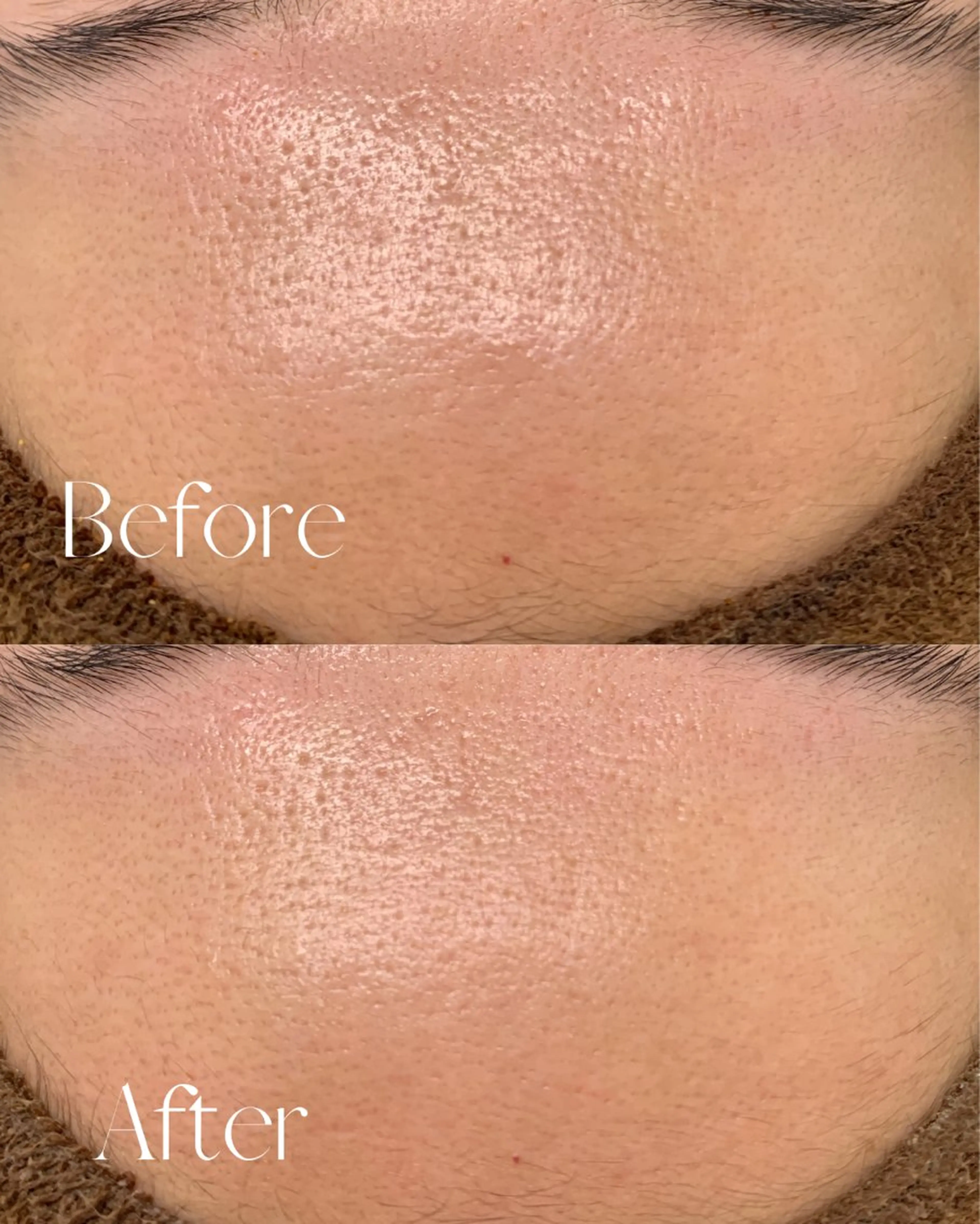 エステ シミ🩷ニキビ専門店 Matteo🎀✨のエステ・リラクイメージ