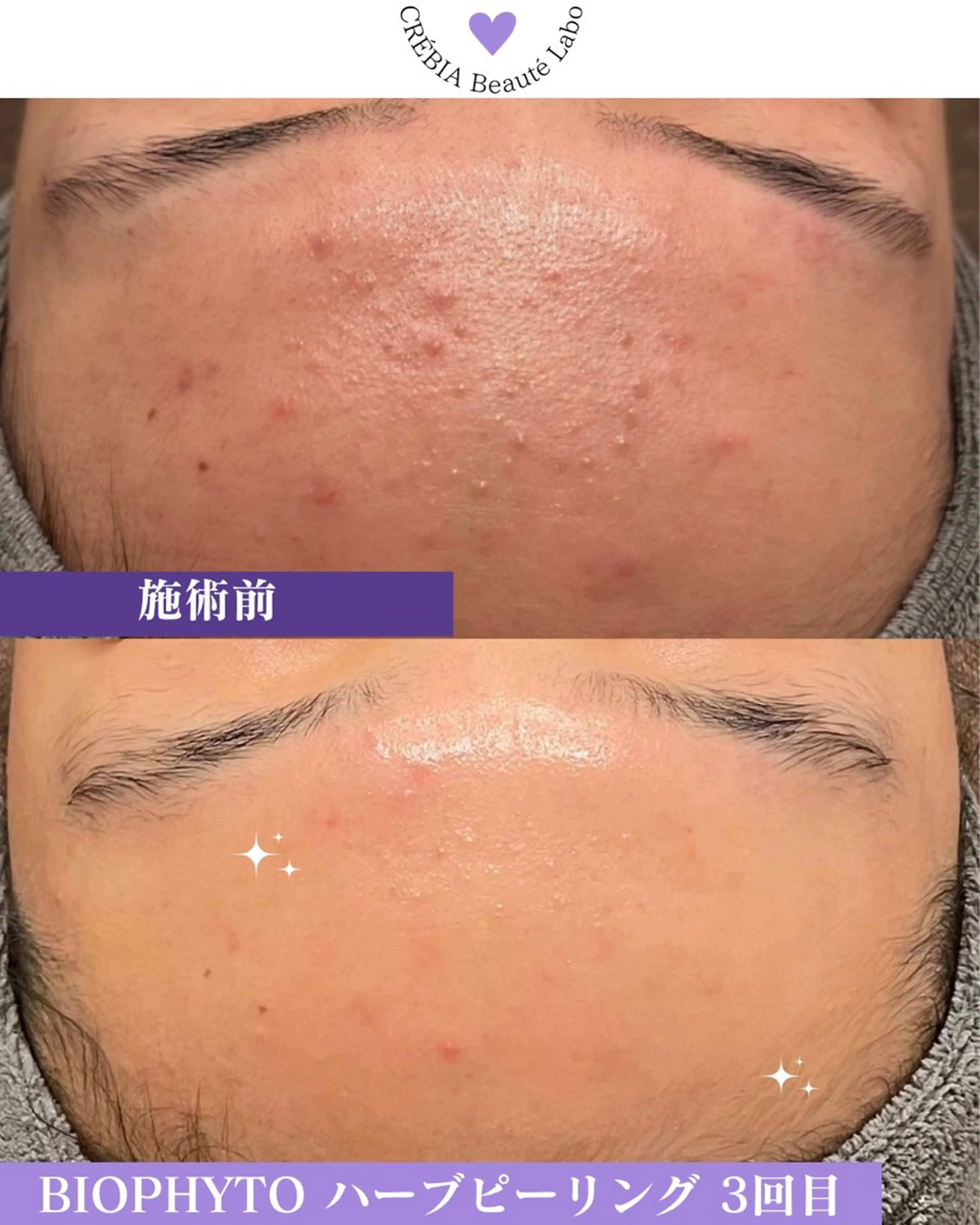 エステ 小顔＆まつ毛サロン AKANE❤️のエステ・リラクイメージ