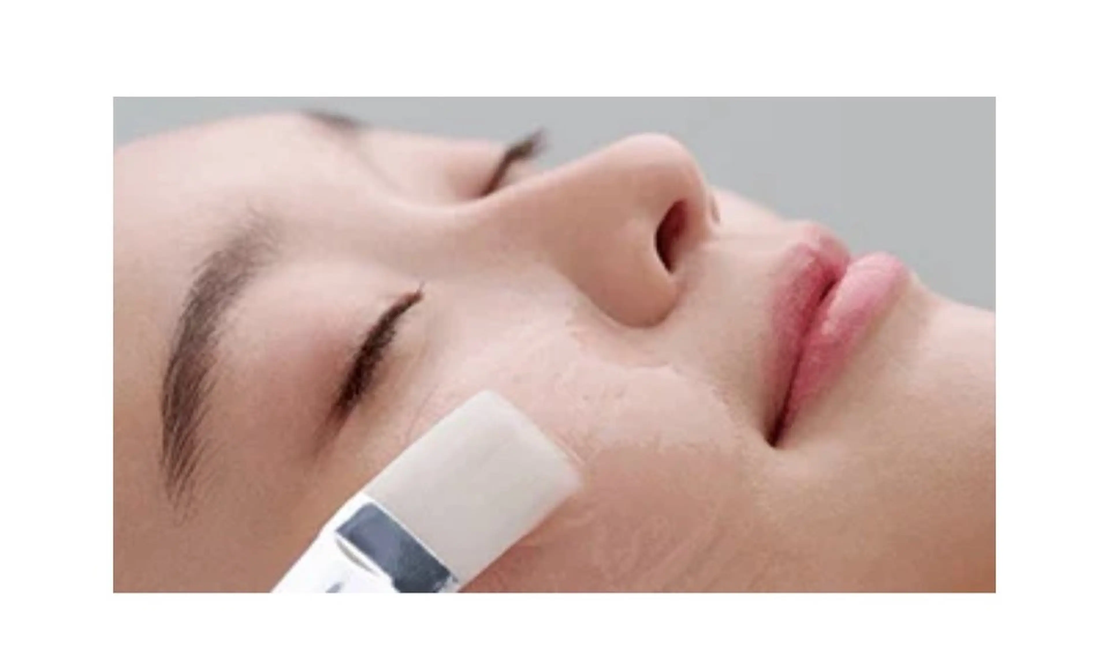 【モニター価格✨】【※期間限定】毛穴スッキリ＆透明感UPフェイシャルエステ＋ピーリング¥2,500の写真