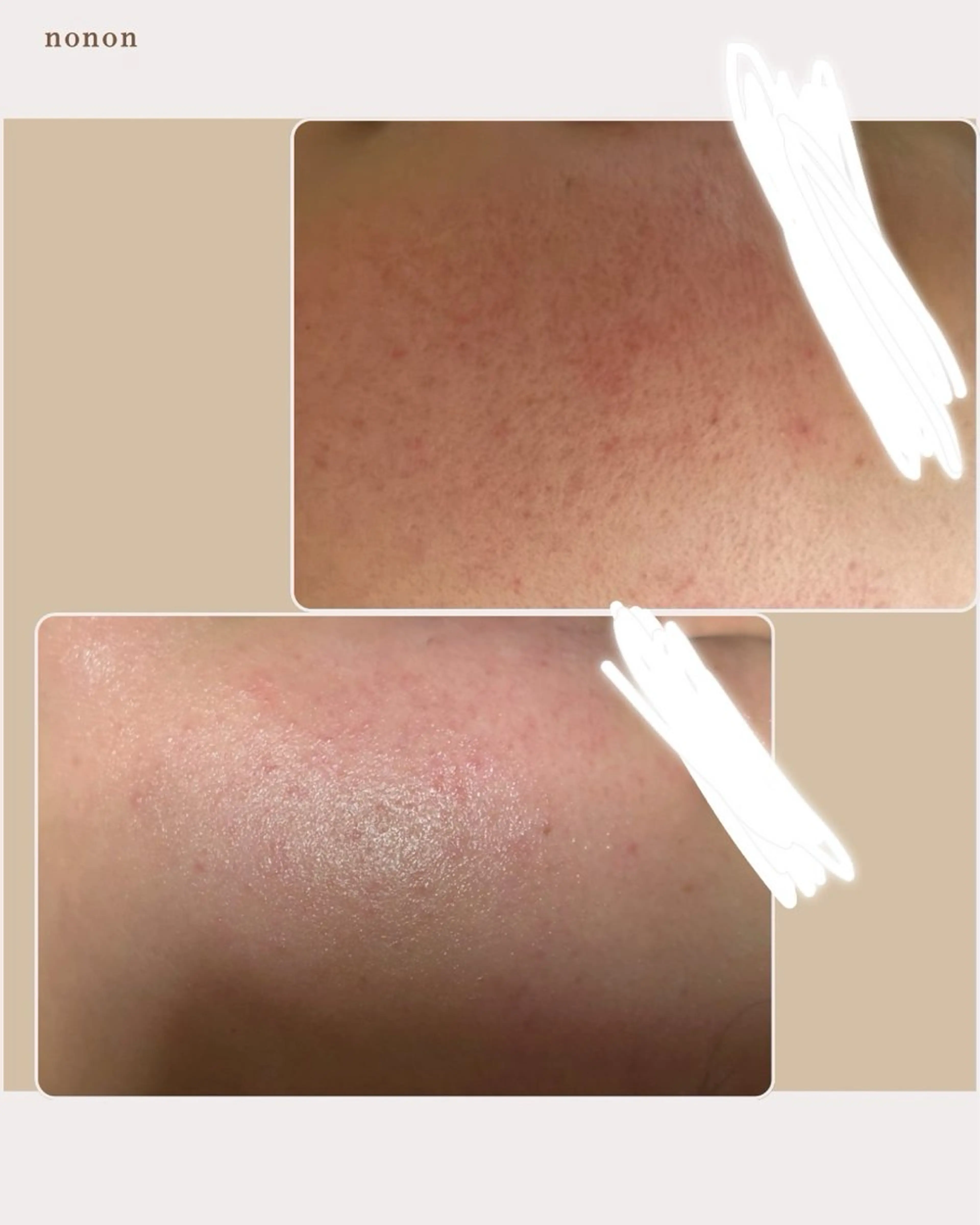 エステ リラク 代謝アップ，浮腫み， 体質改善のエステ・リラクイメージ