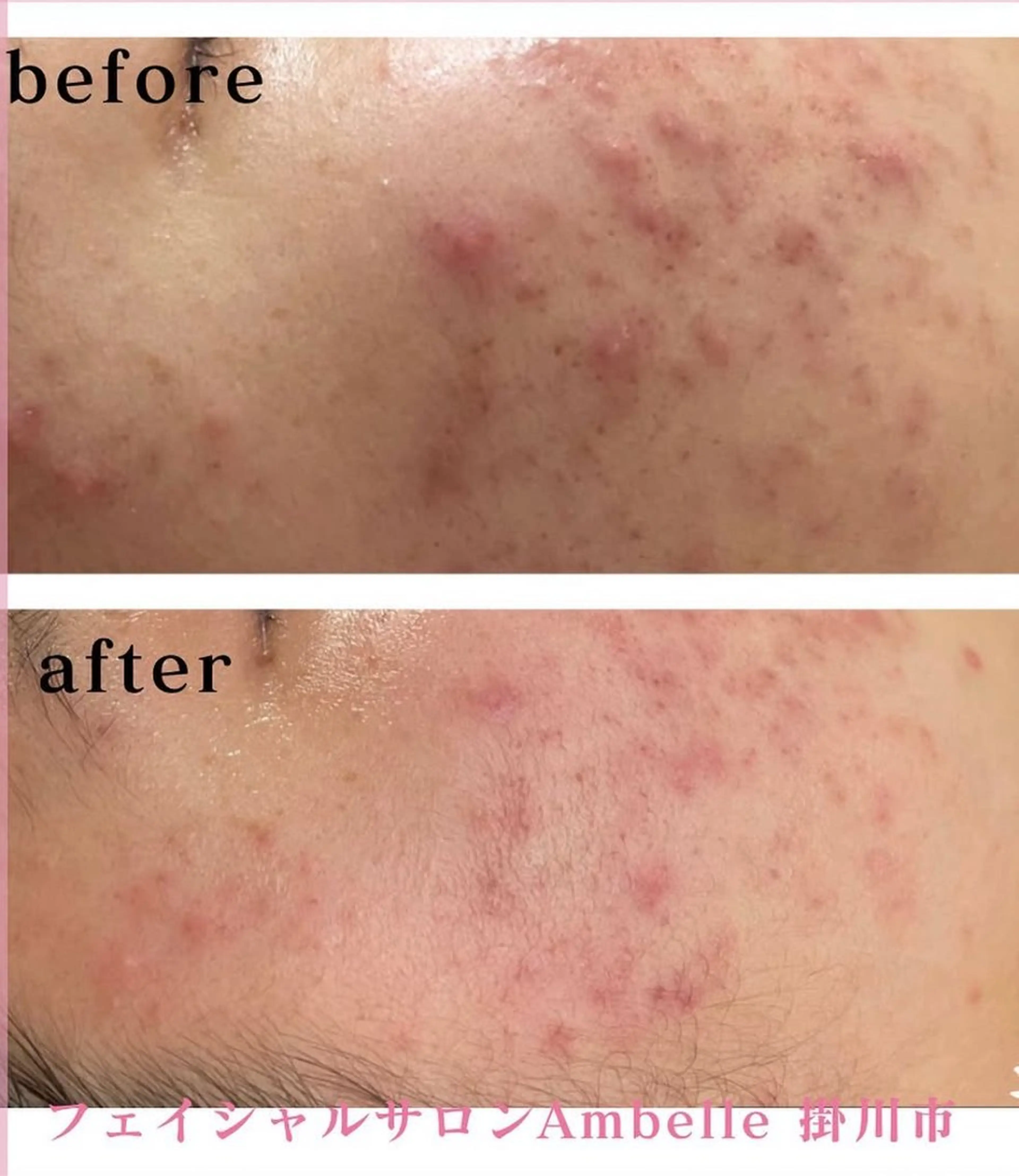 エステ 北川 亜友美のエステ・リラクイメージ