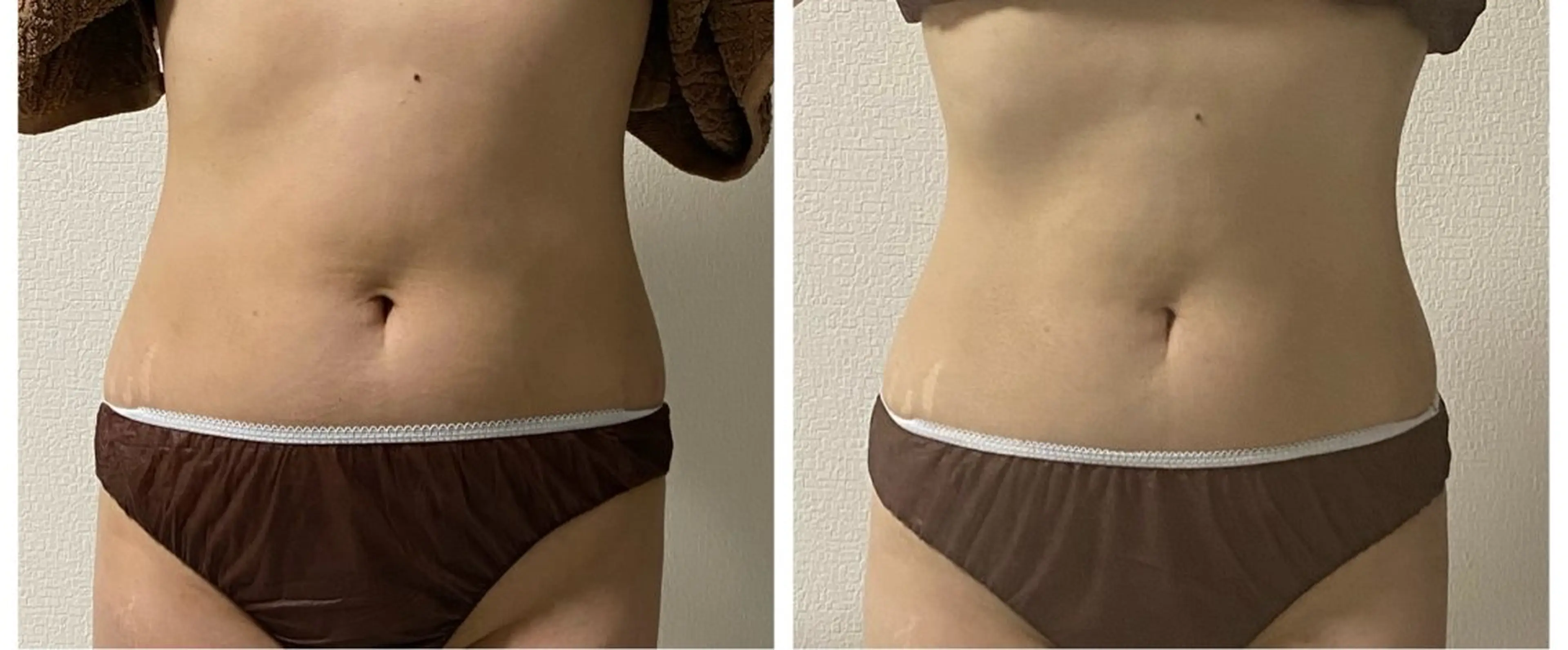 自宅サロン KaLmiaのエステ・リラクイメージ