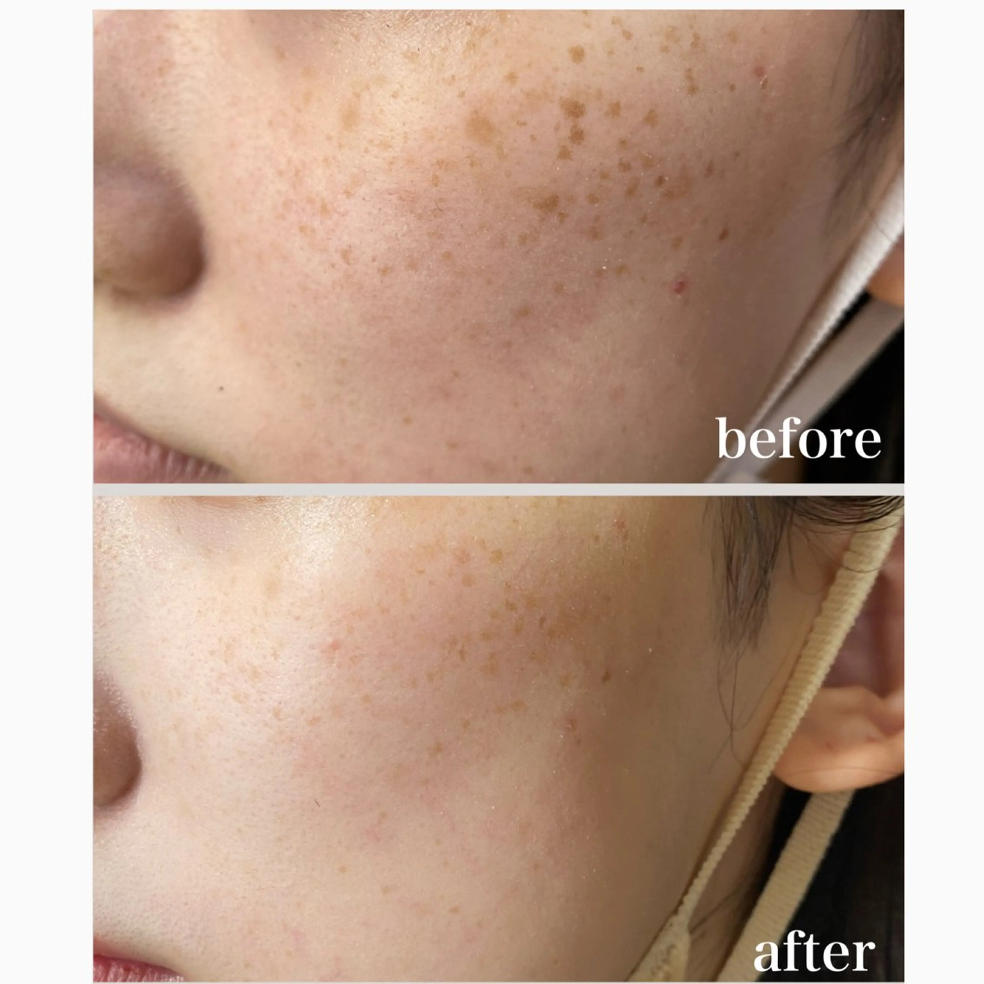 エステ Red Moat所属・Red Moatのマツエク・マツパデザイン