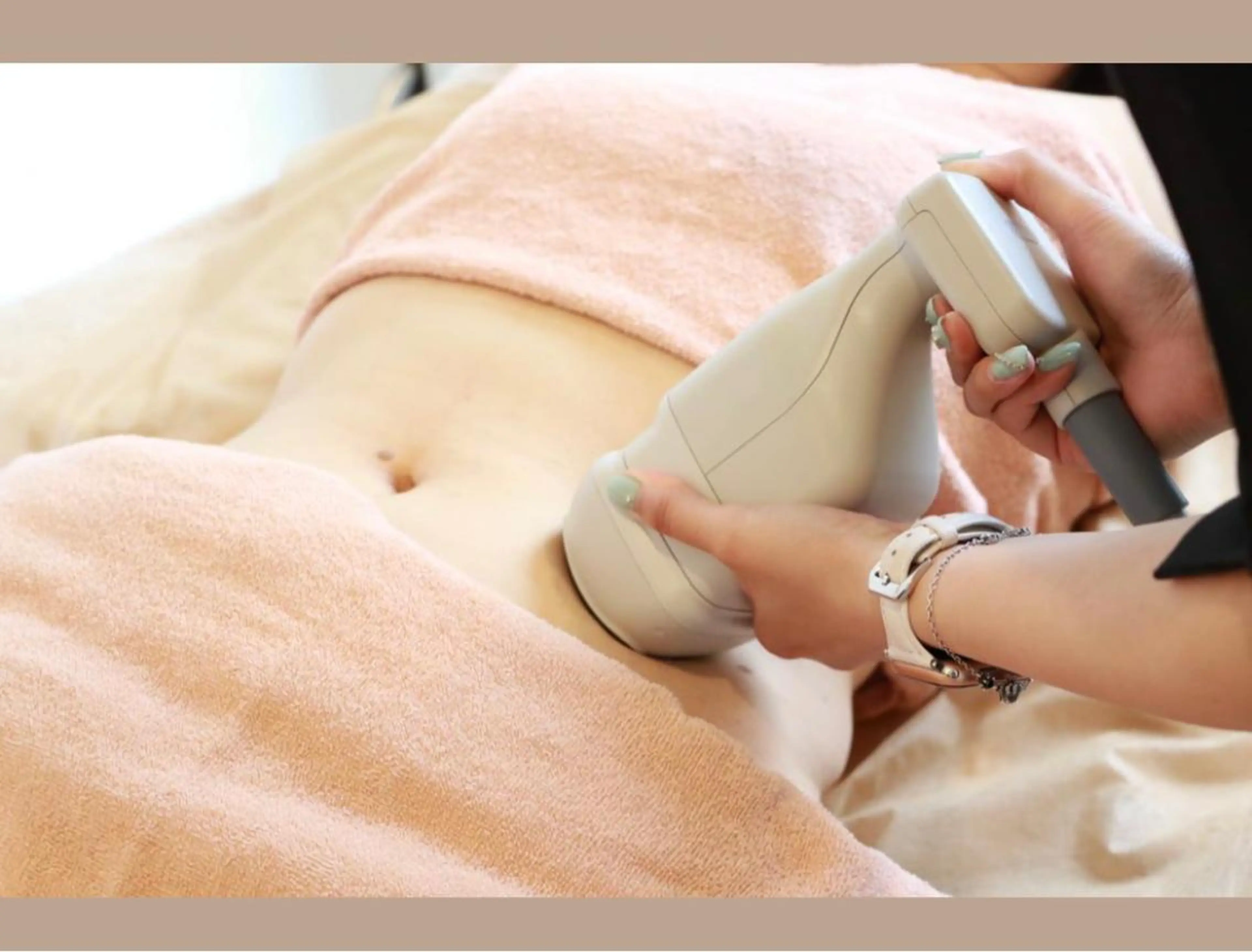 （レディース）VIO1回の写真