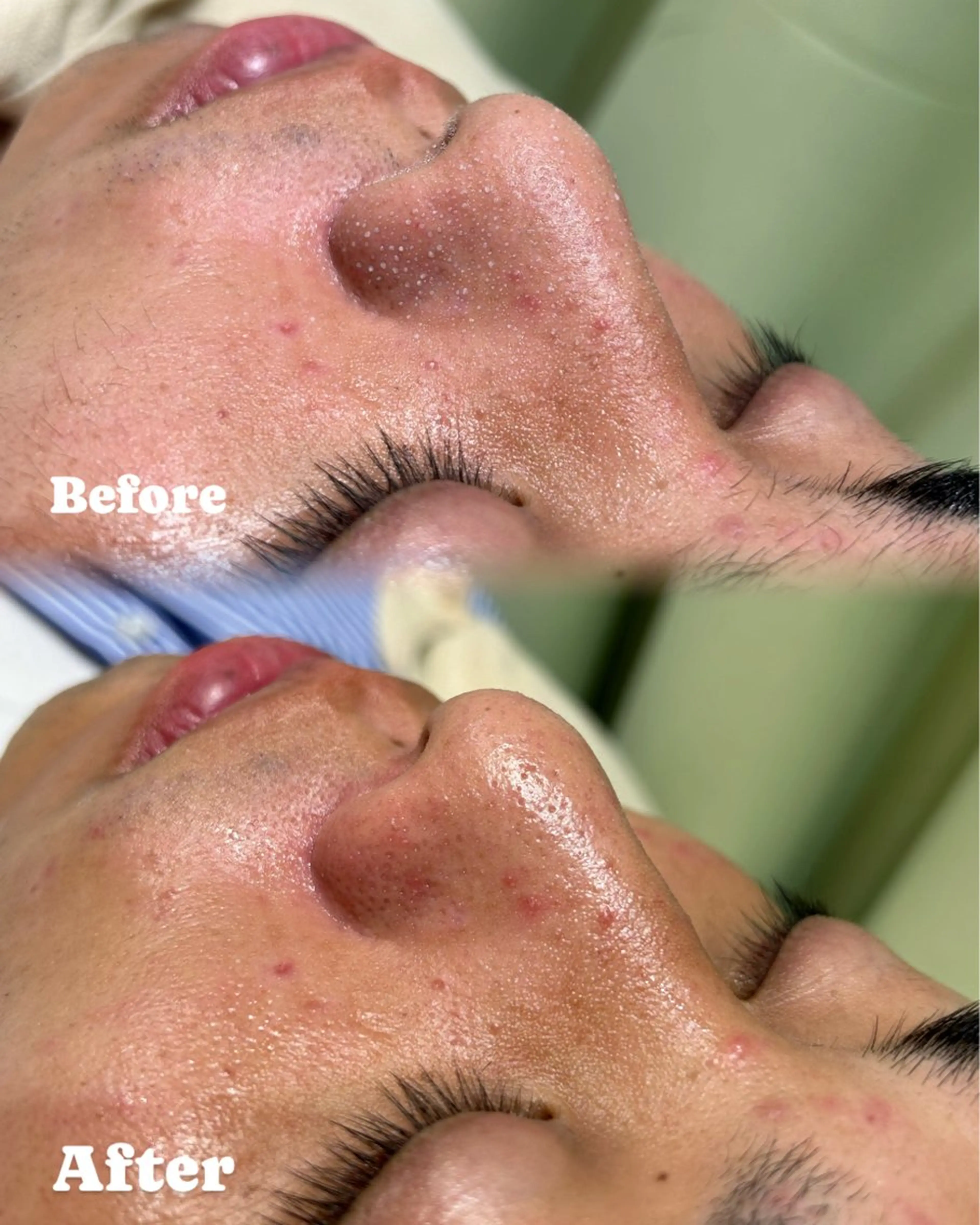 エステ リラク 🫧美しい素肌へ🫧 今成柚乃のその他イメージ