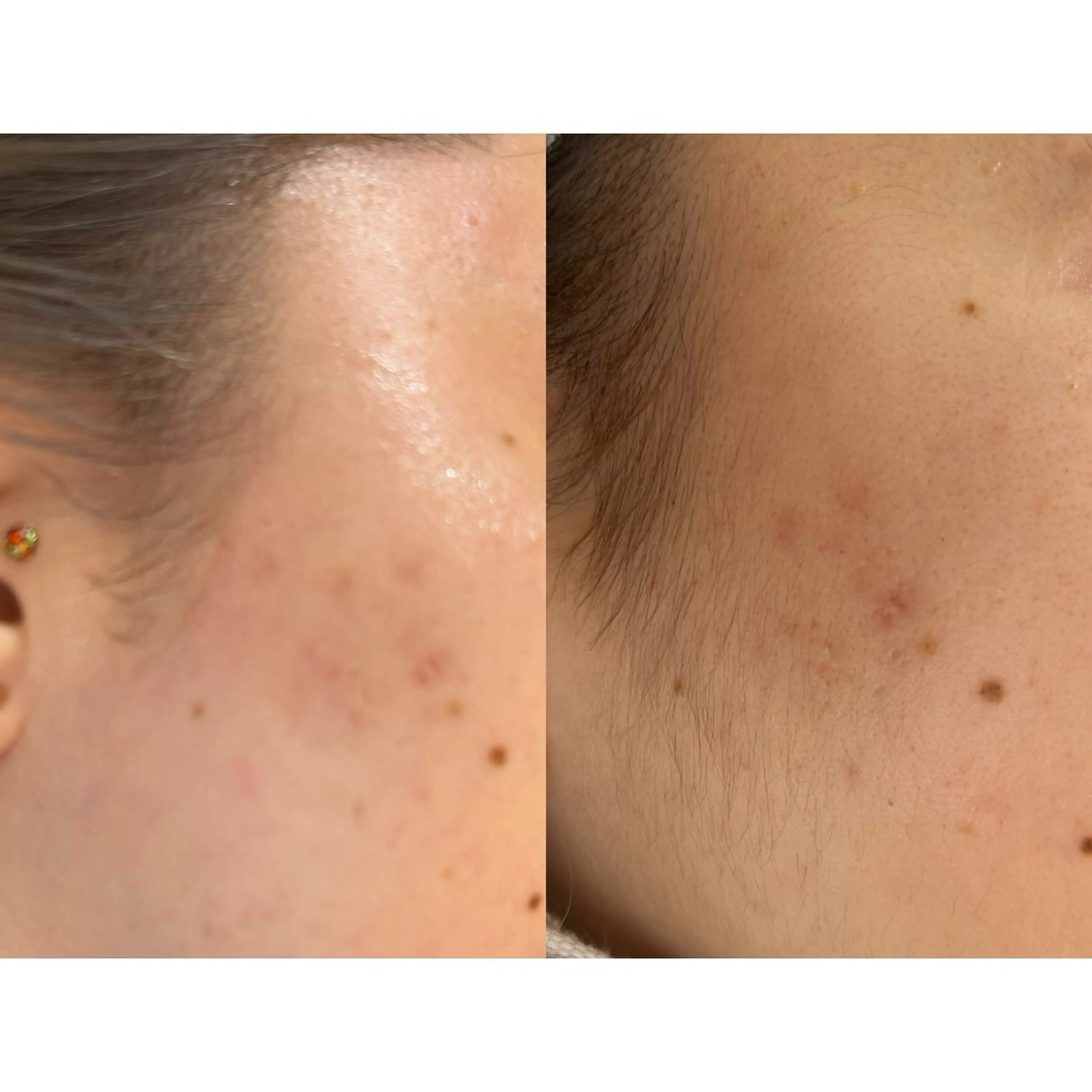 ワックス脱毛🌈 ESPOIRnocoのエステ・リラクイメージ