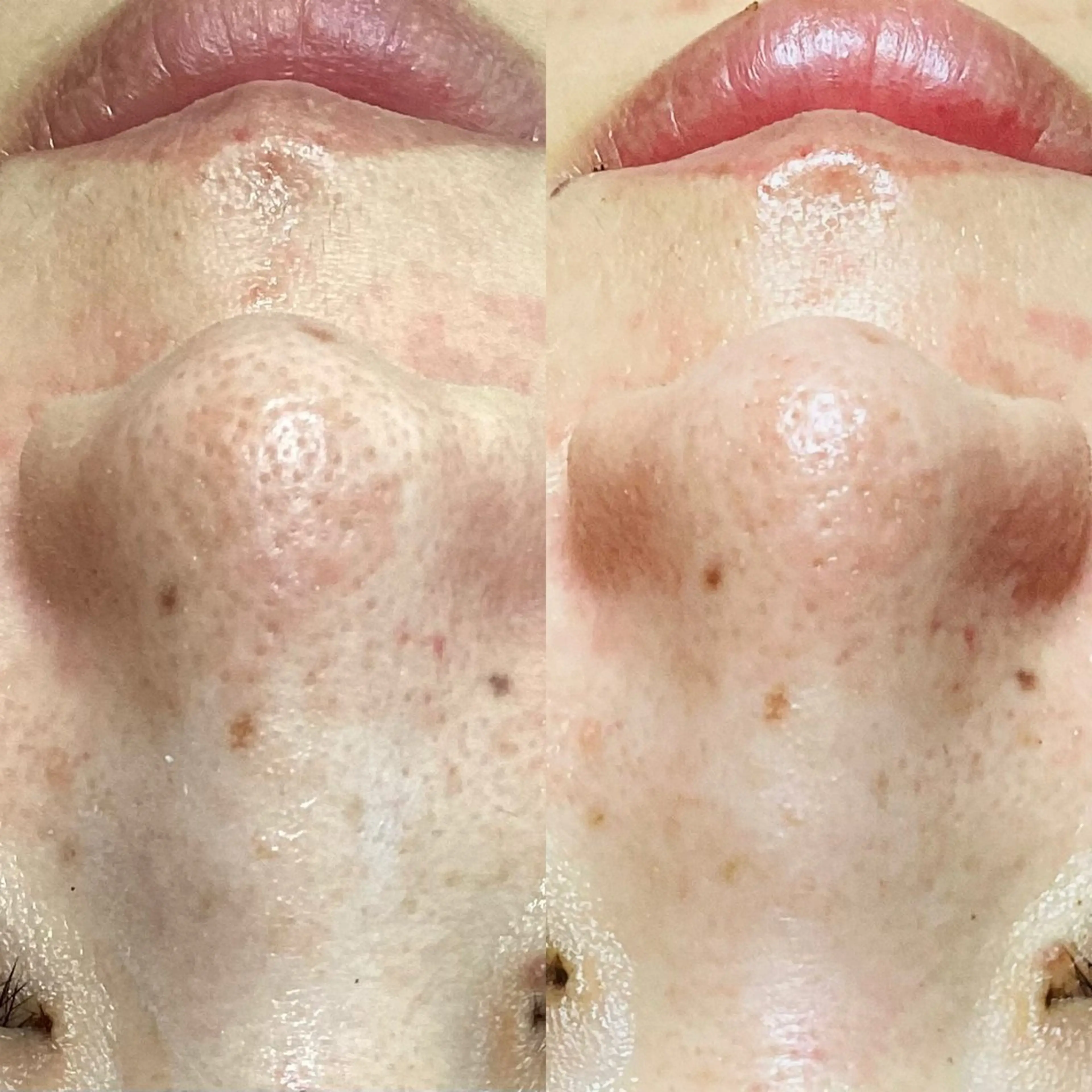 エステ Rifuro毛穴ケア &よもぎ蒸しサロンの眉毛・アイブロウイメージ