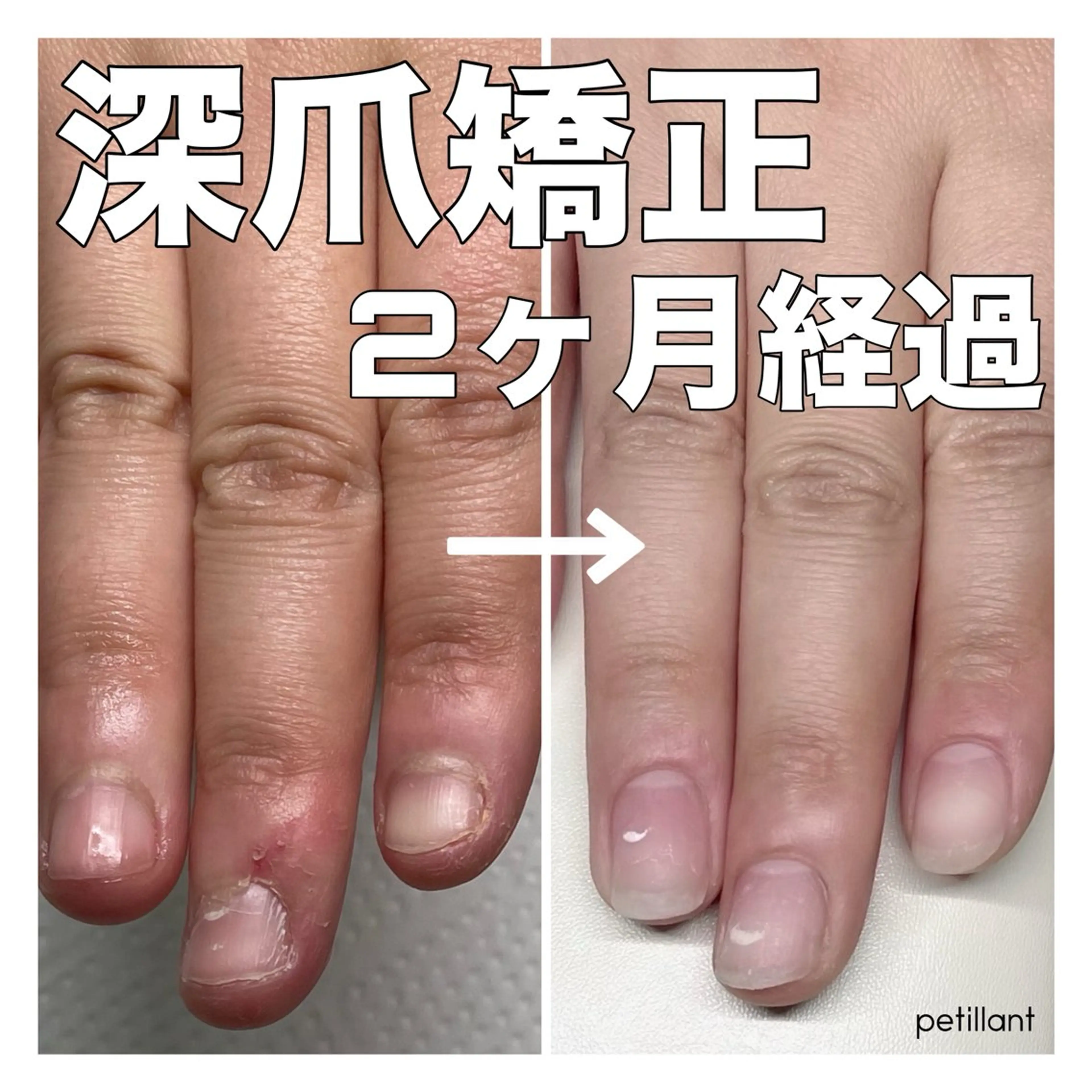 ネイル 入学式 卒業式 ハンドネイル ハンドケア nail salon petillantのネイルデザイン