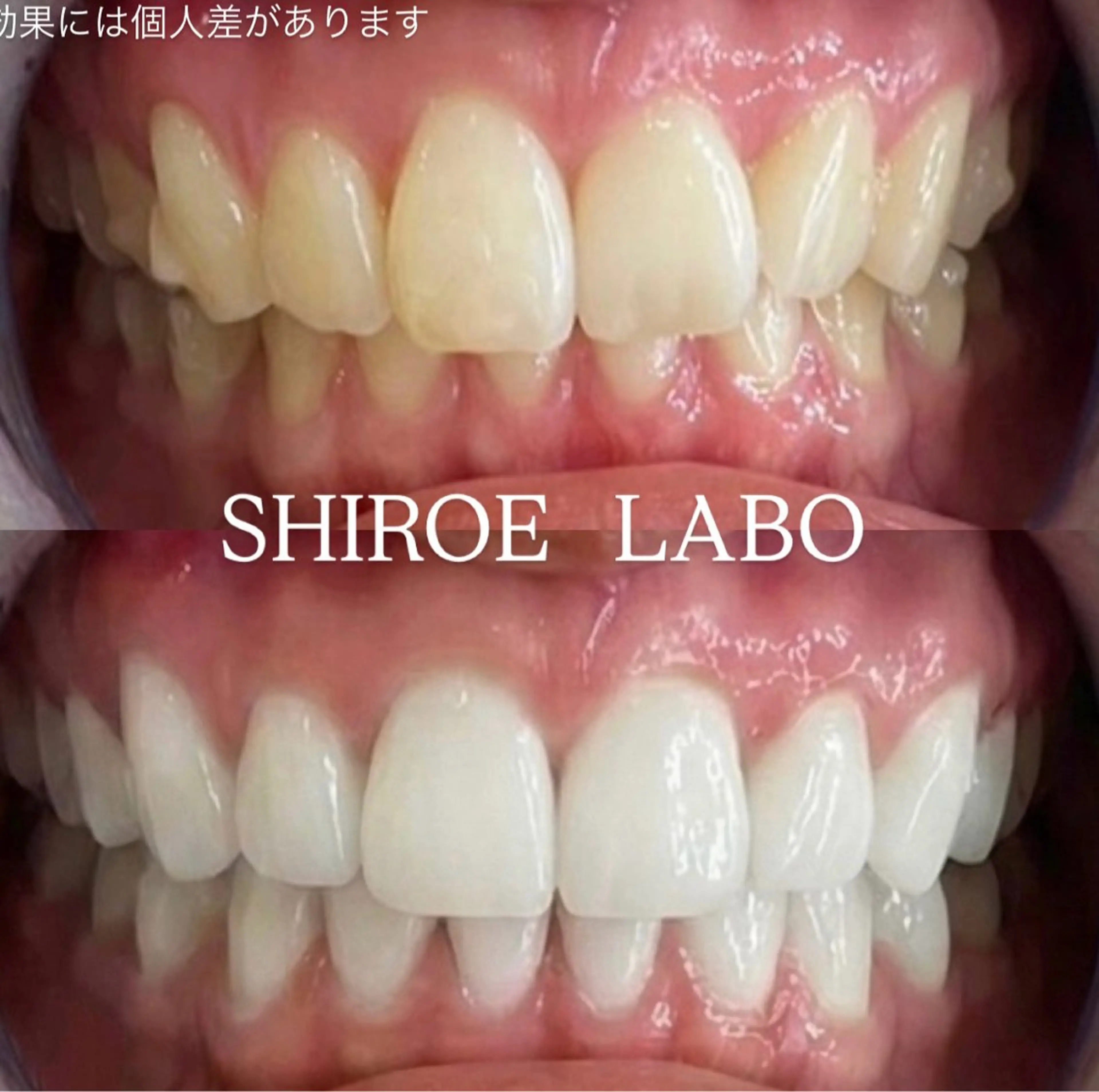 その他 【歯のホワイトニング専門店】シロエラボ梅田店所属・シロエラボ 梅田店のその他イメージ