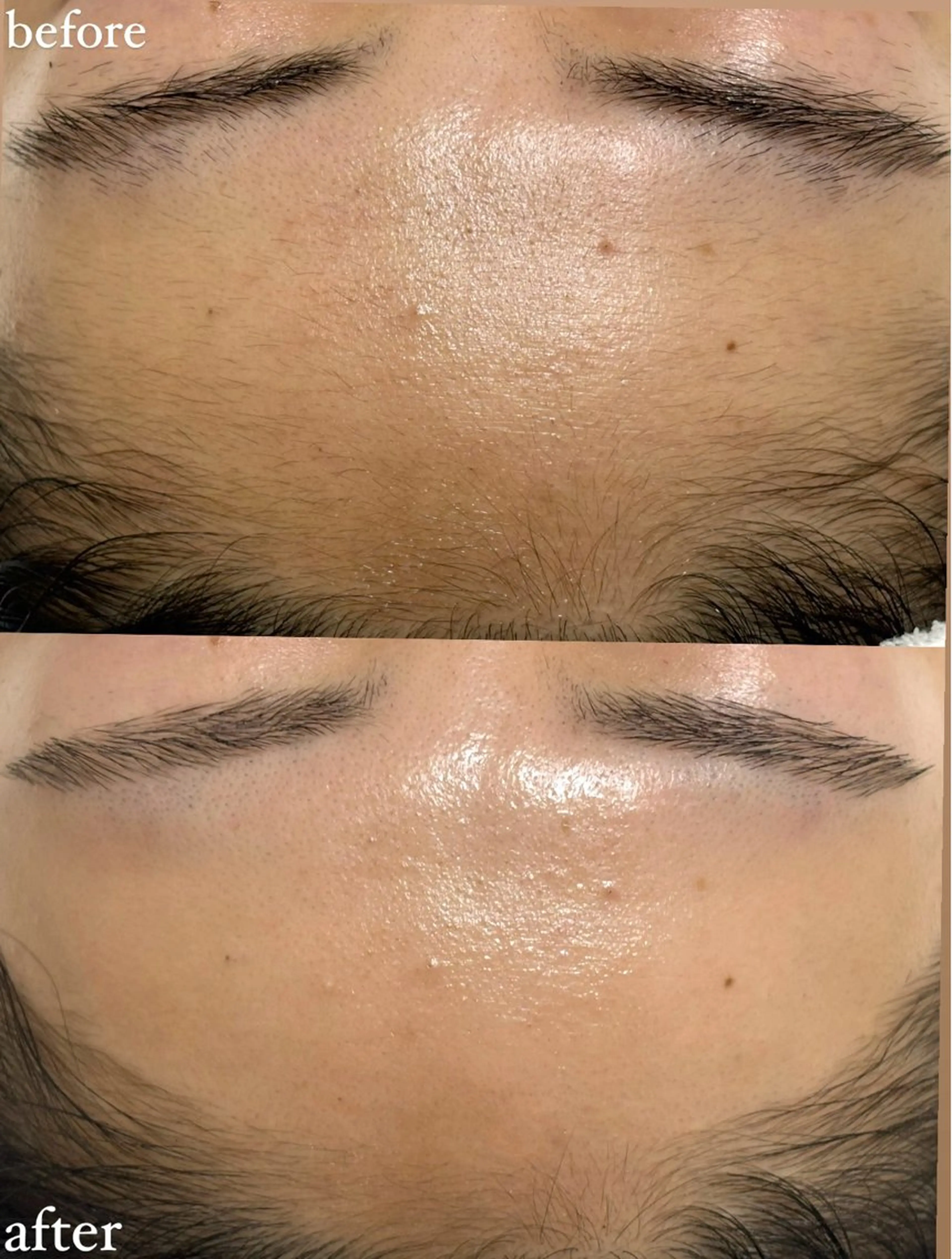 女性専門お顔剃り sunraineのエステ・リラクイメージ