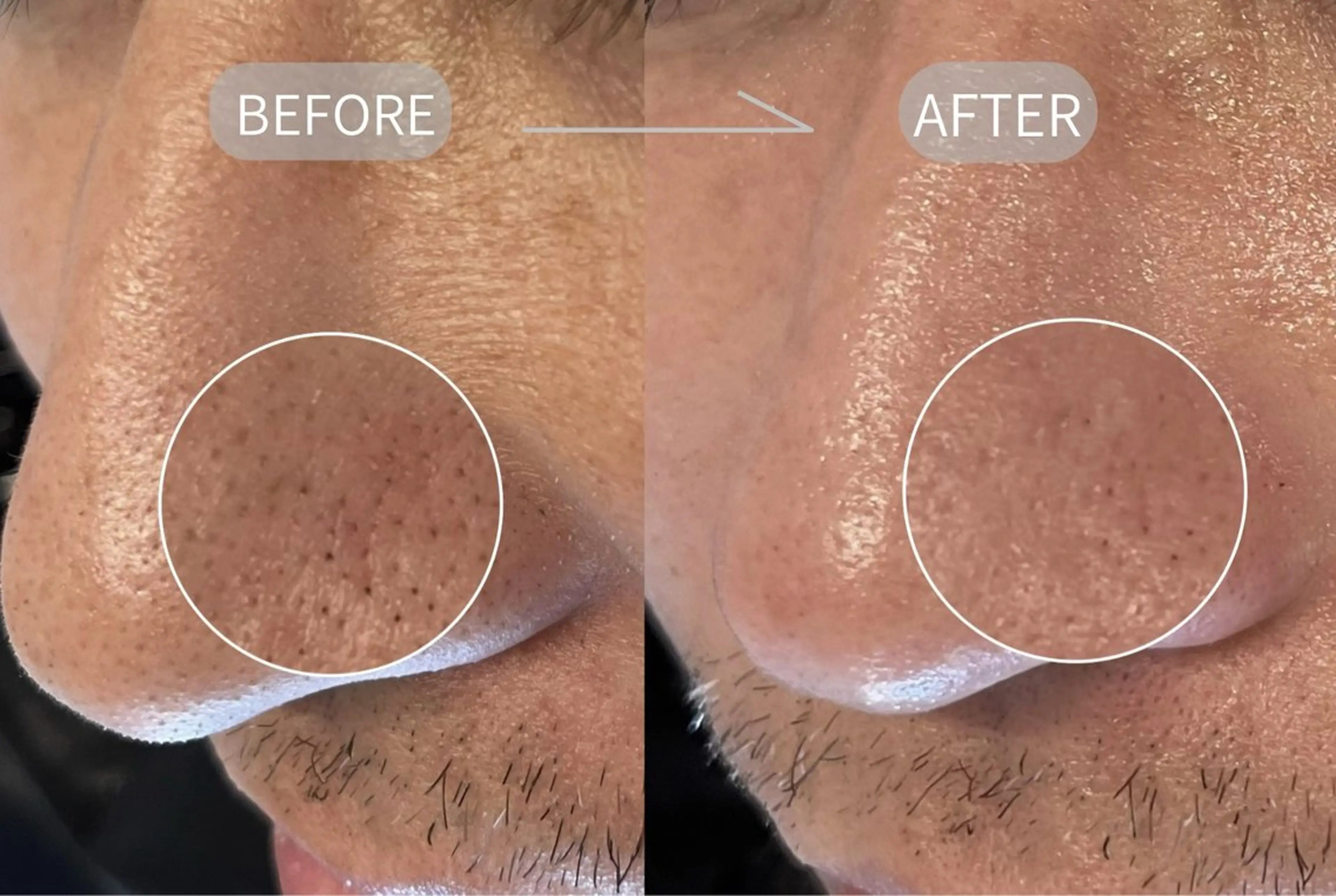 エステ 眉毛/毛穴ｹｱ 専門 nogi/Hottaの眉毛・アイブロウイメージ