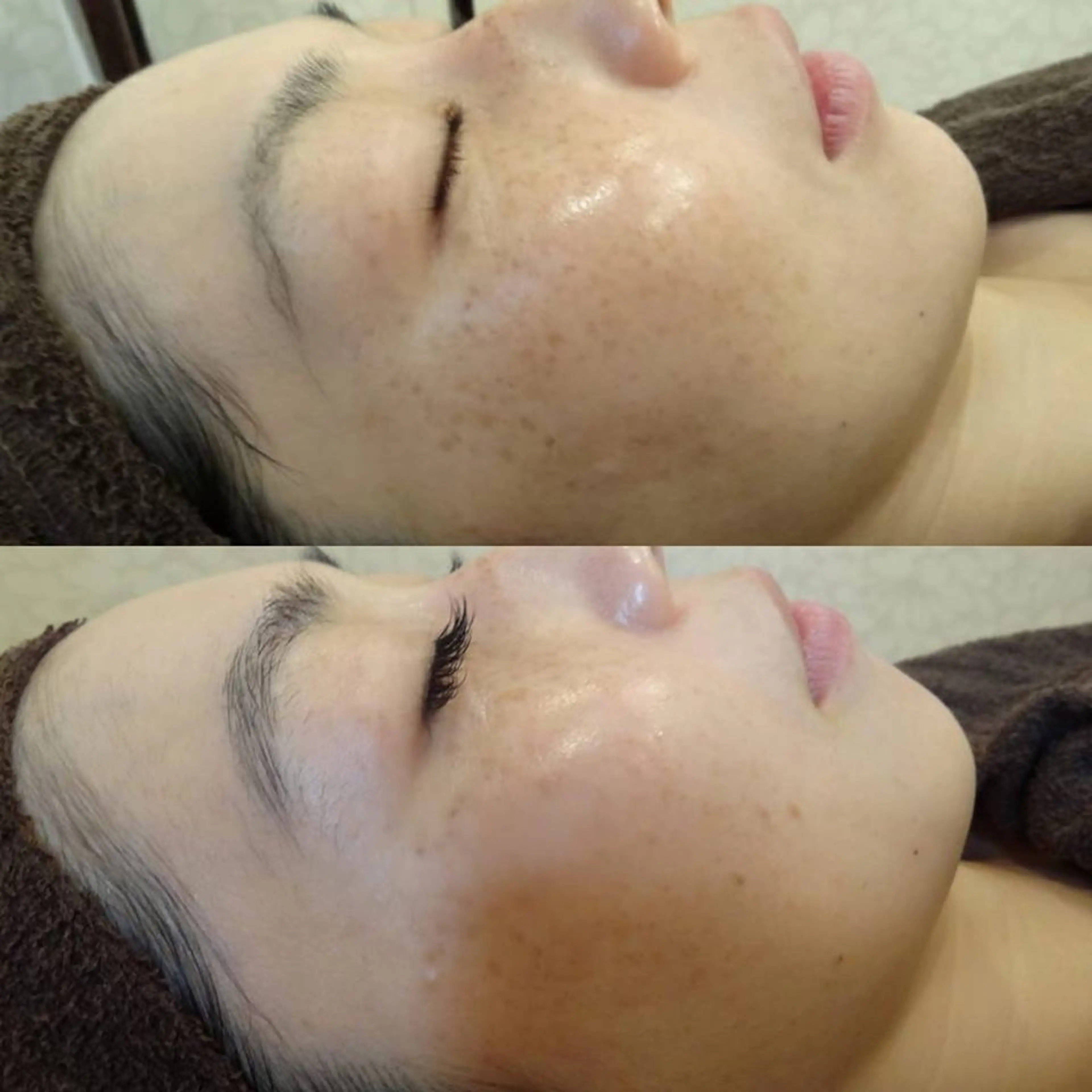 エステ vary  clue MISAのその他イメージ