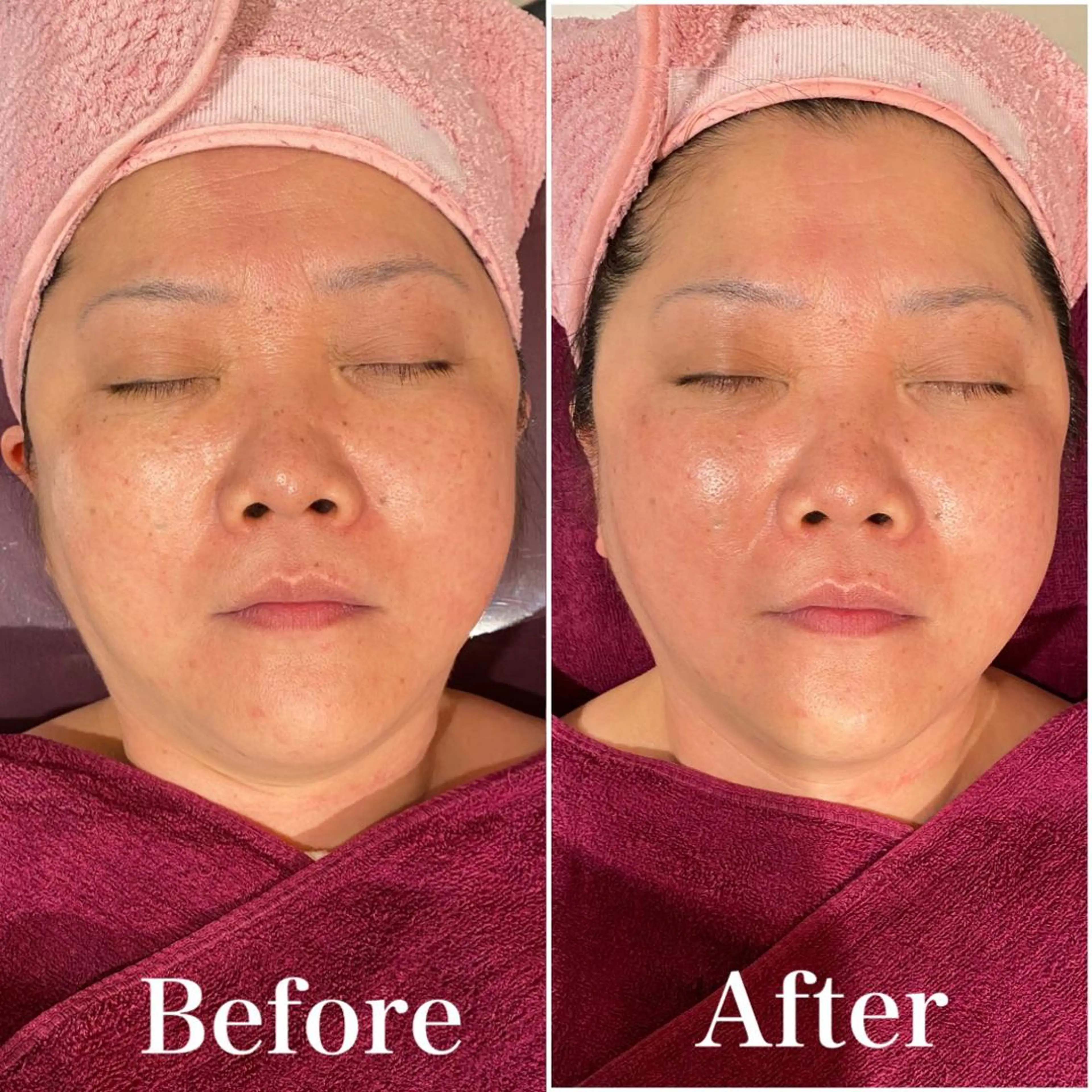 リオッサ  オブ ラグーン神戸店のエステ・リラクイメージ