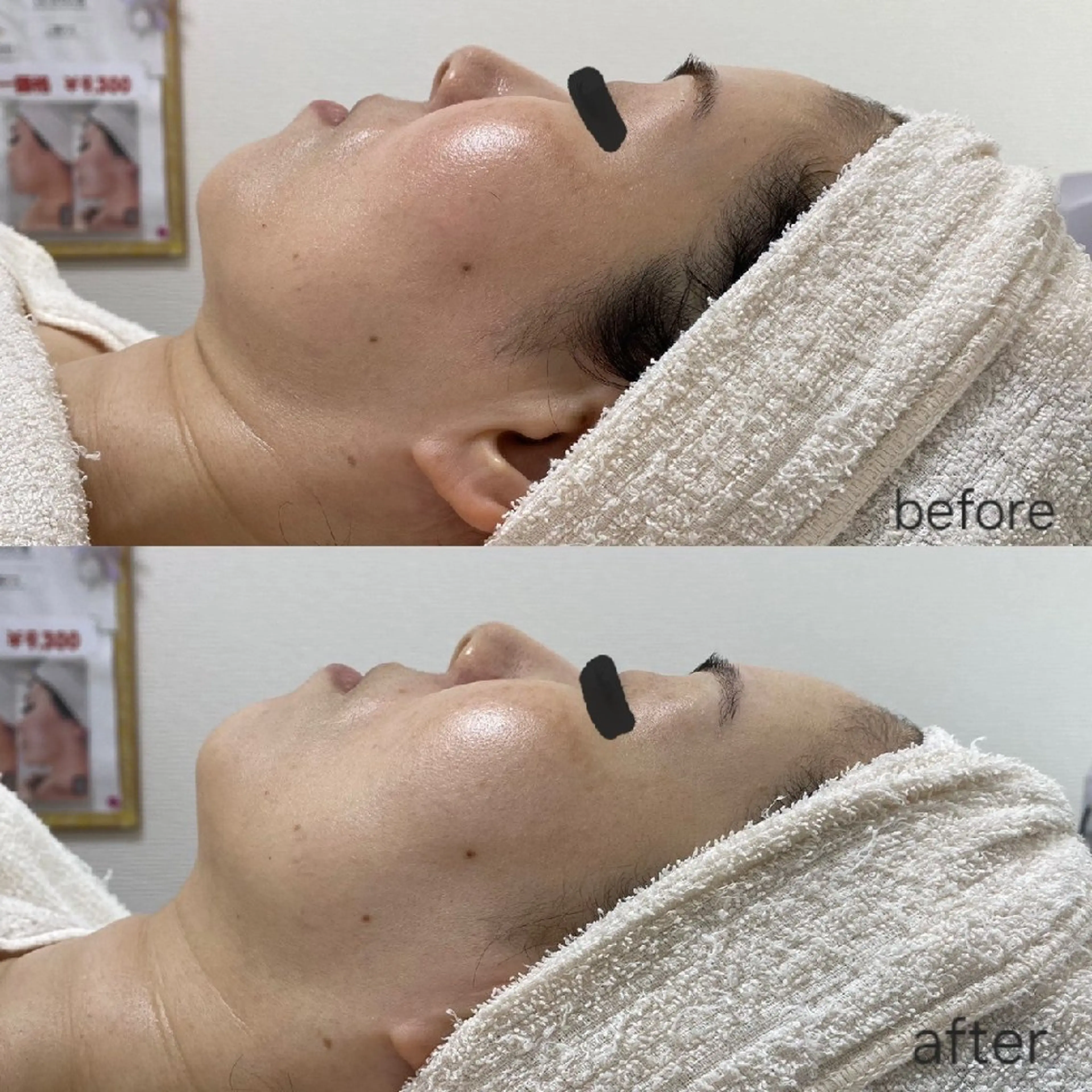 ニキビ・ニキビ跡専門 レゾン京橋店　のエステ・リラクイメージ