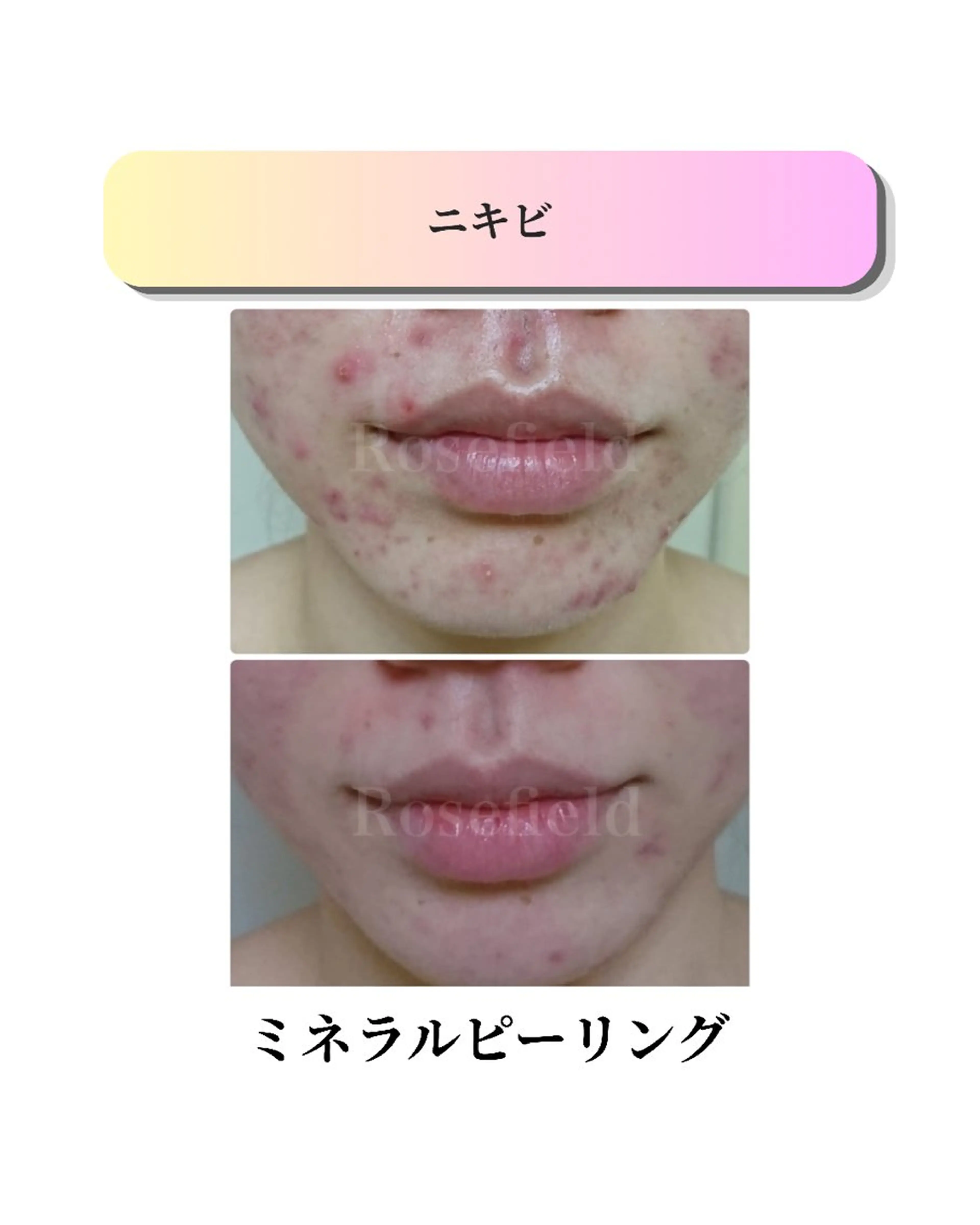 エステ ローズフィールド 森岡朋美のエステ・リラクイメージ