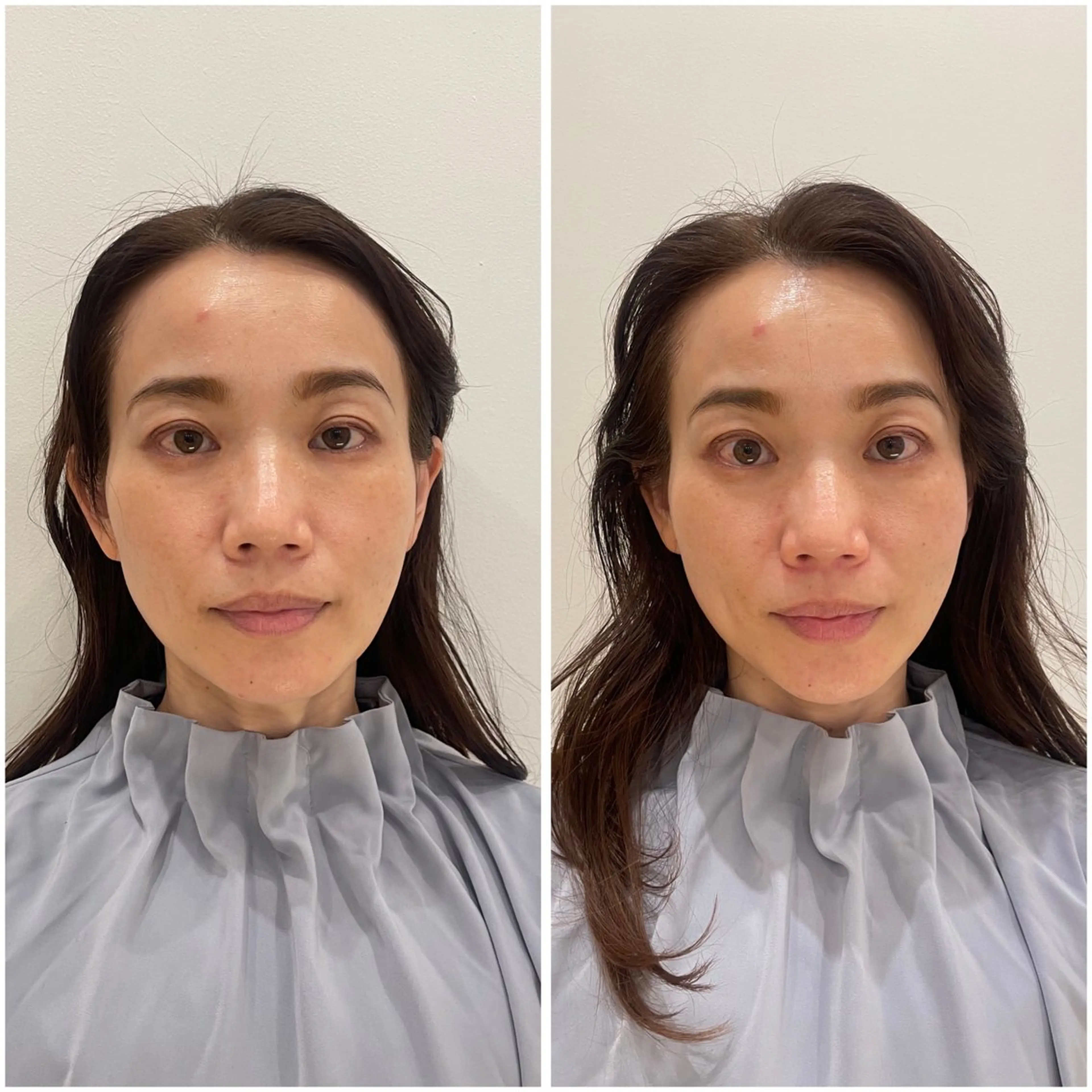 エステ リラク 🌸美容鍼サロン🌸 メゾンブランシェ🌈のエステ・リラクイメージ