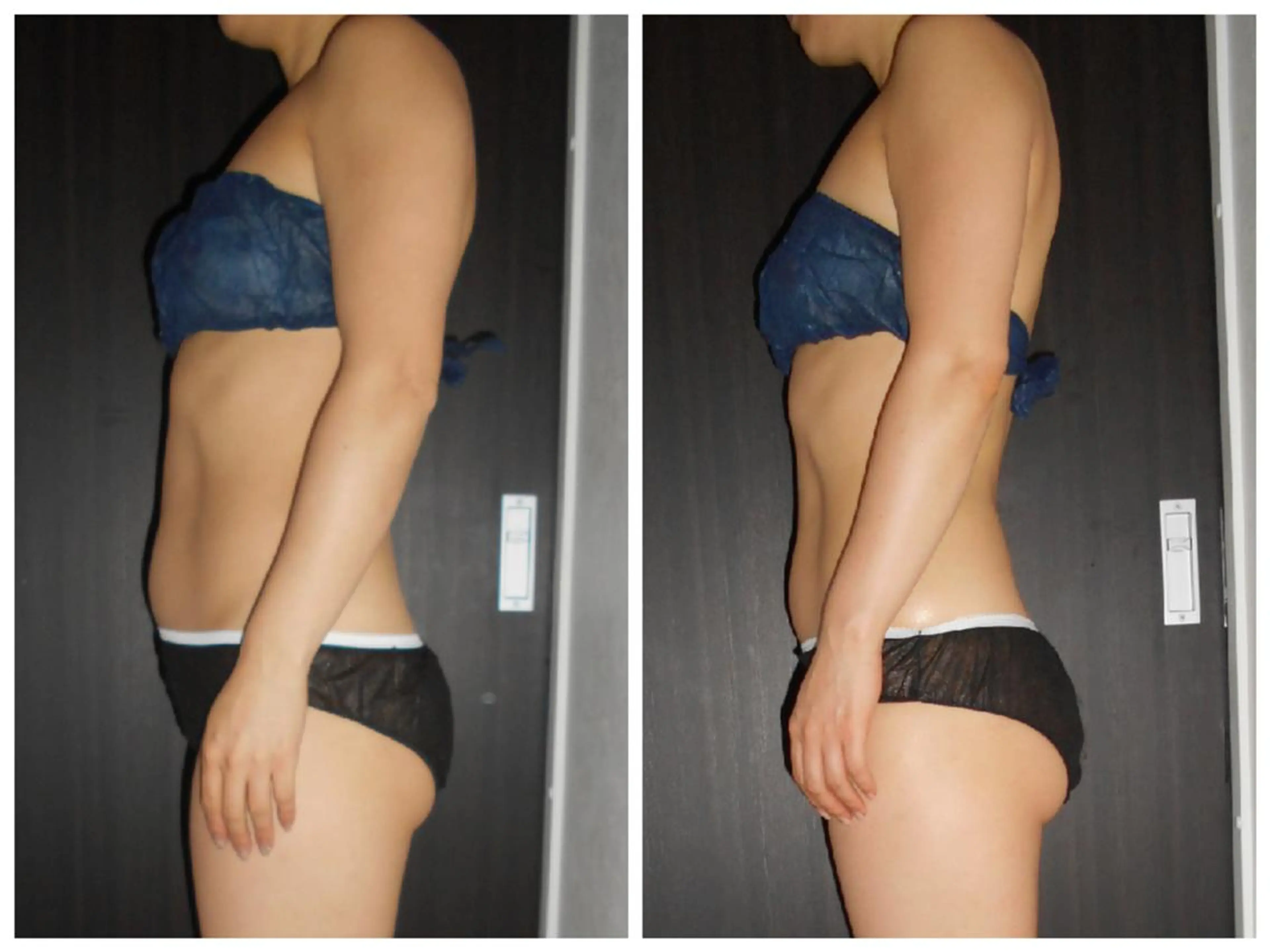 小顔専門店 グレイスボディ三郷店のエステ・リラクイメージ