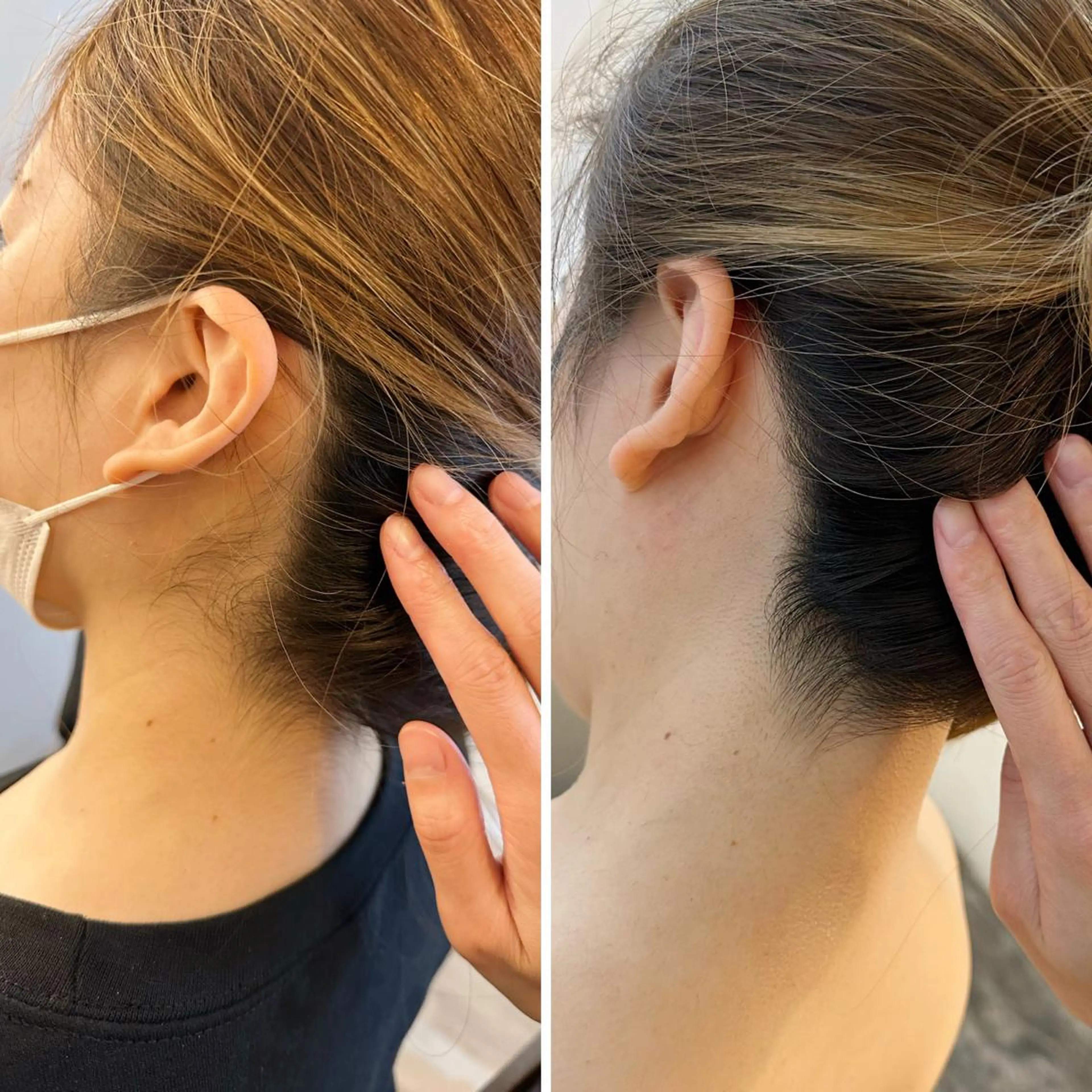 脱毛 うなじ脱毛/美肌脱毛 LABELのエステ・リラクイメージ