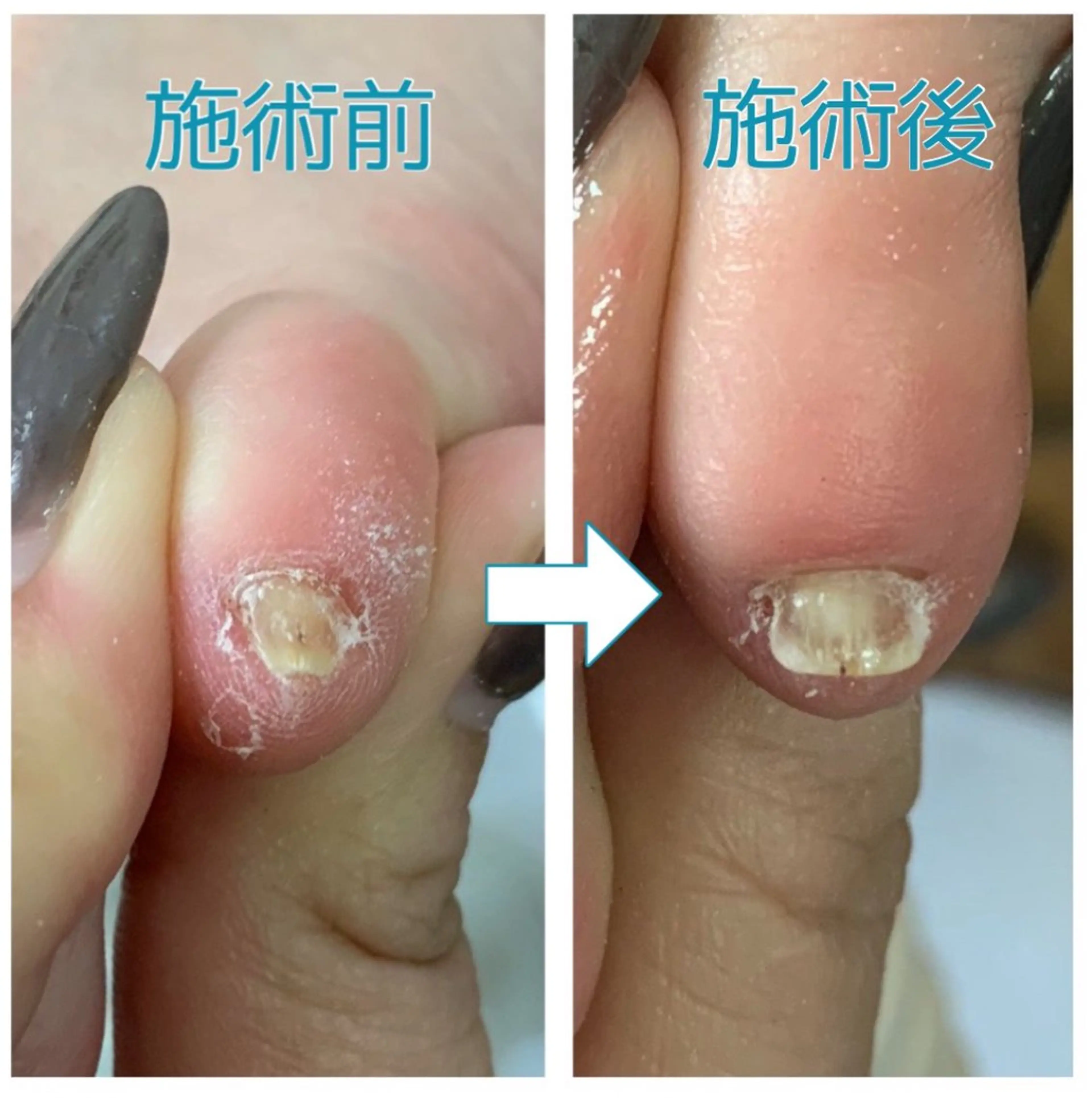 ネイル ネイルサロンailes所属・ネイルサロンエール 店長沼尻のネイルデザイン