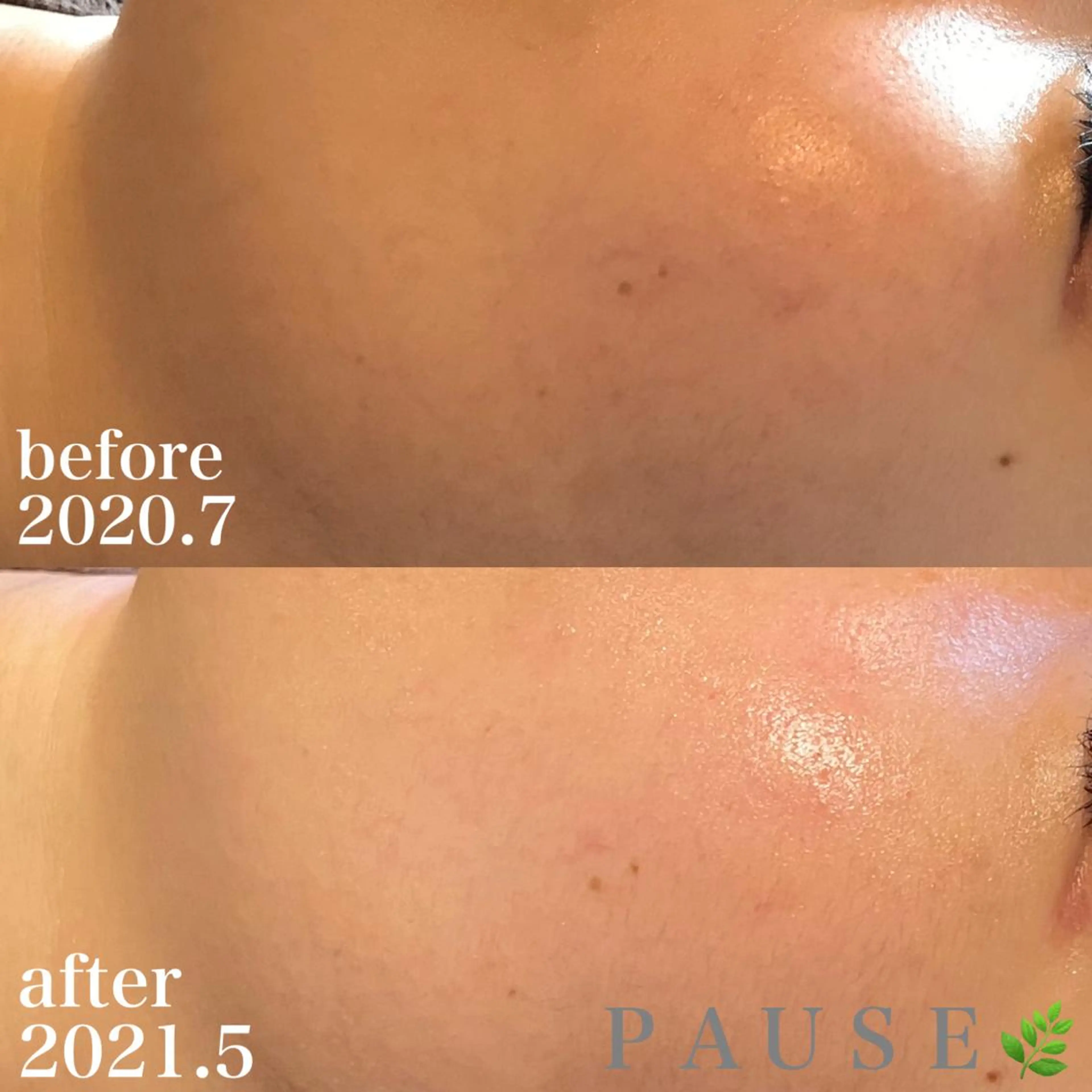 エステ 浜野 恵美のエステ・リラクイメージ