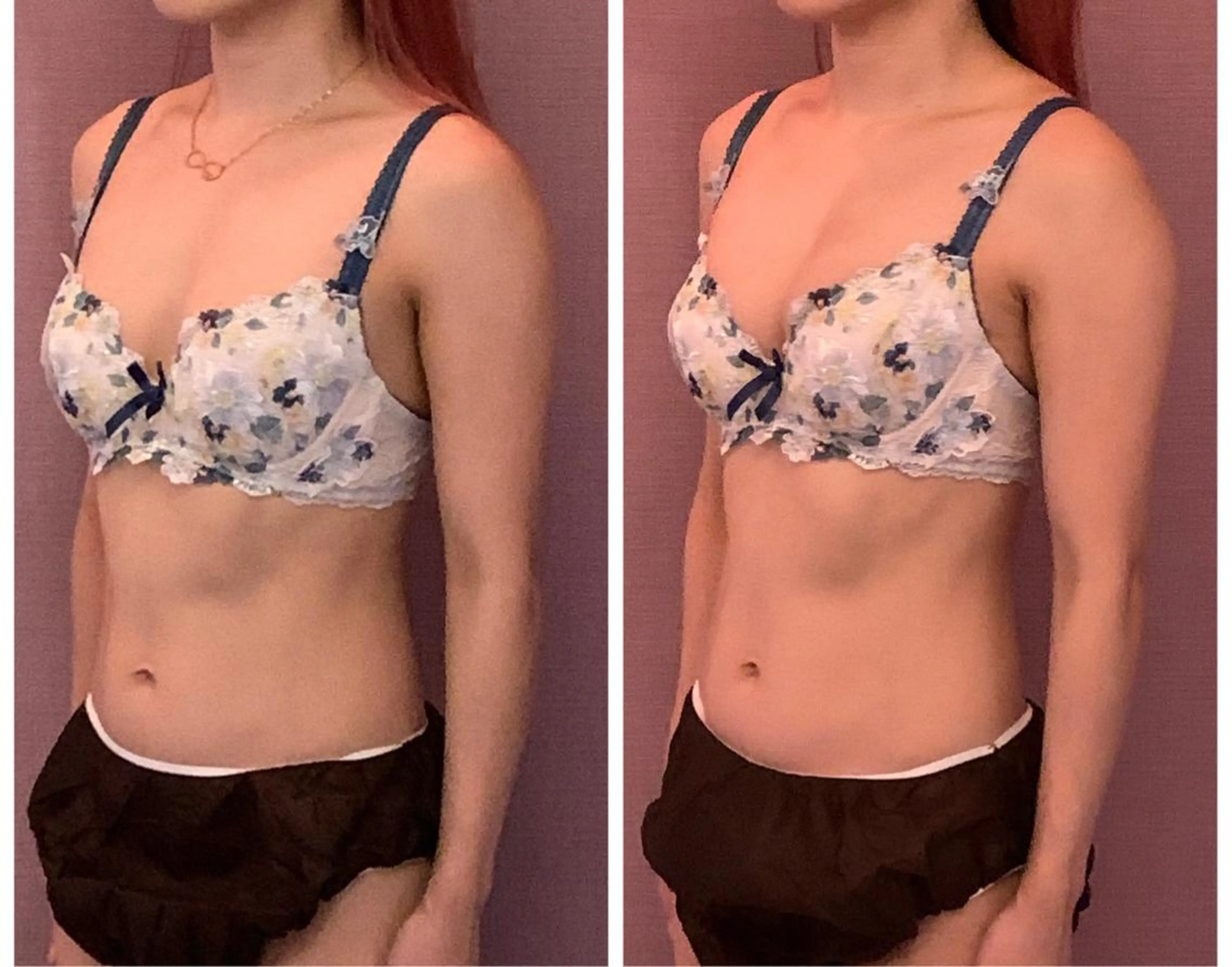 エステ リラク アンベリーノ Yuuriのエステ・リラクイメージ