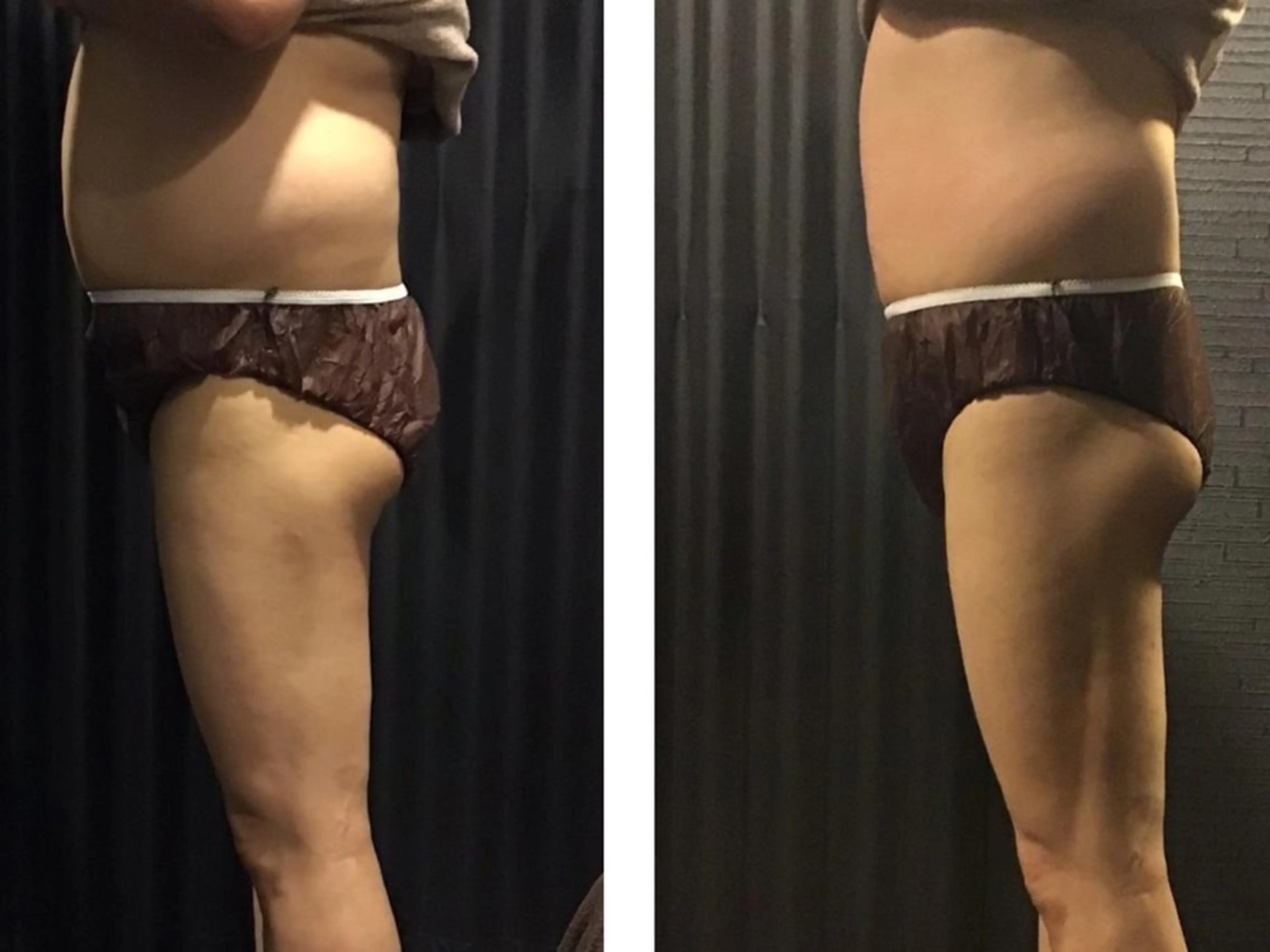 横浜エステサロン R-ing リングのエステ・リラクイメージ