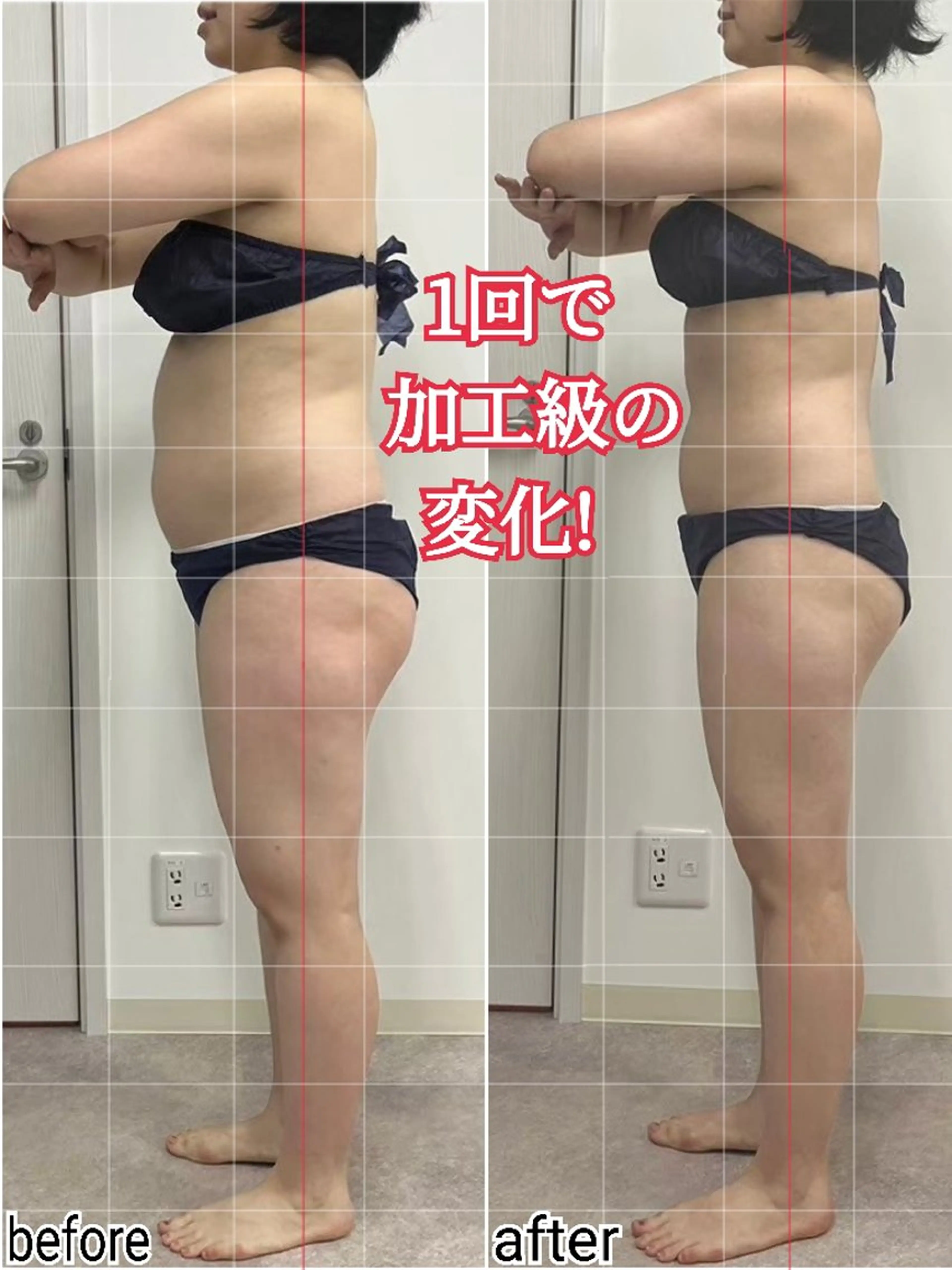 痛くない！歪みも癒しも痩身も👍️軟部組織リリース100分の写真