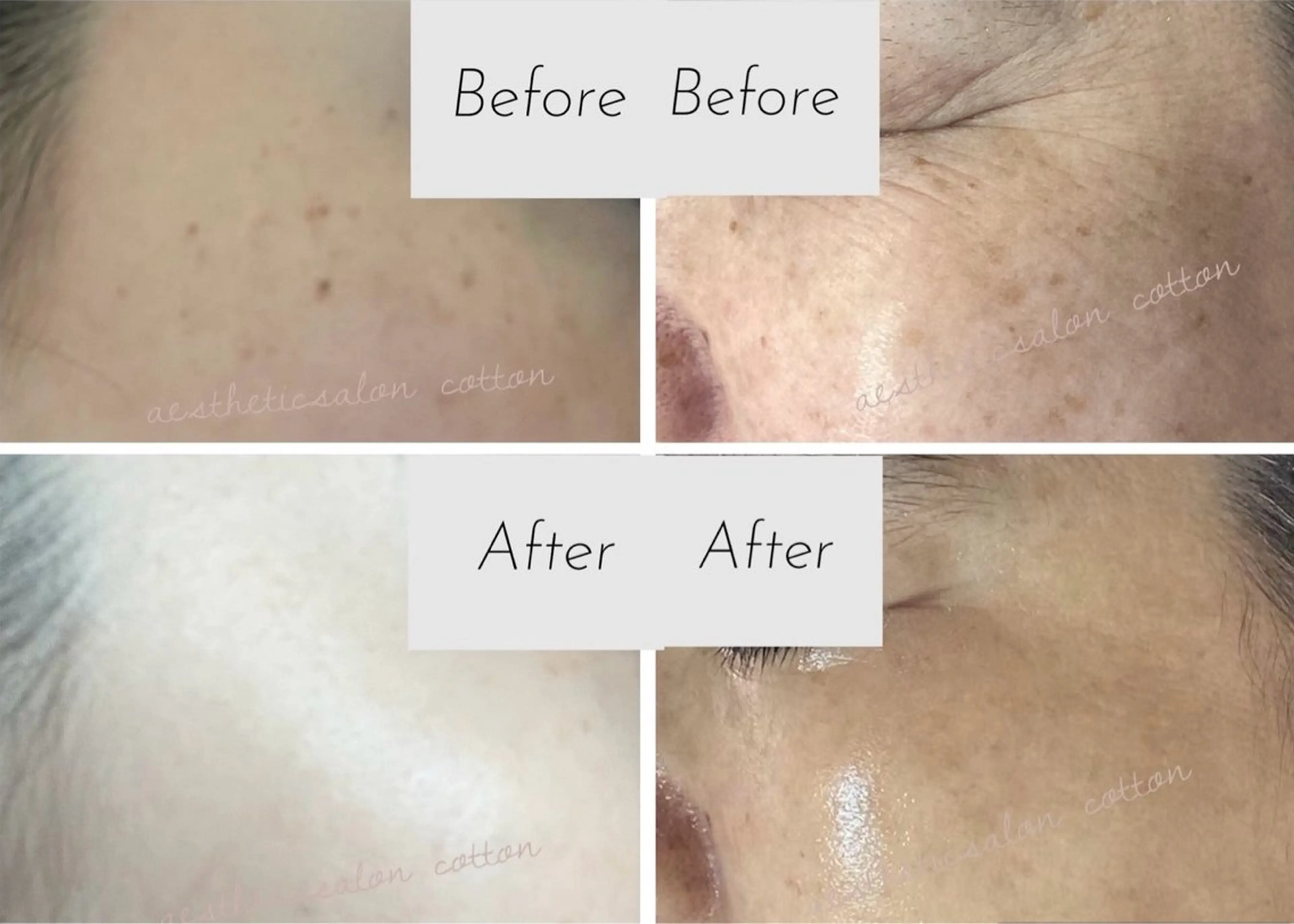 エステ 都度払い 肌質改善専門サロンのエステ・リラクイメージ