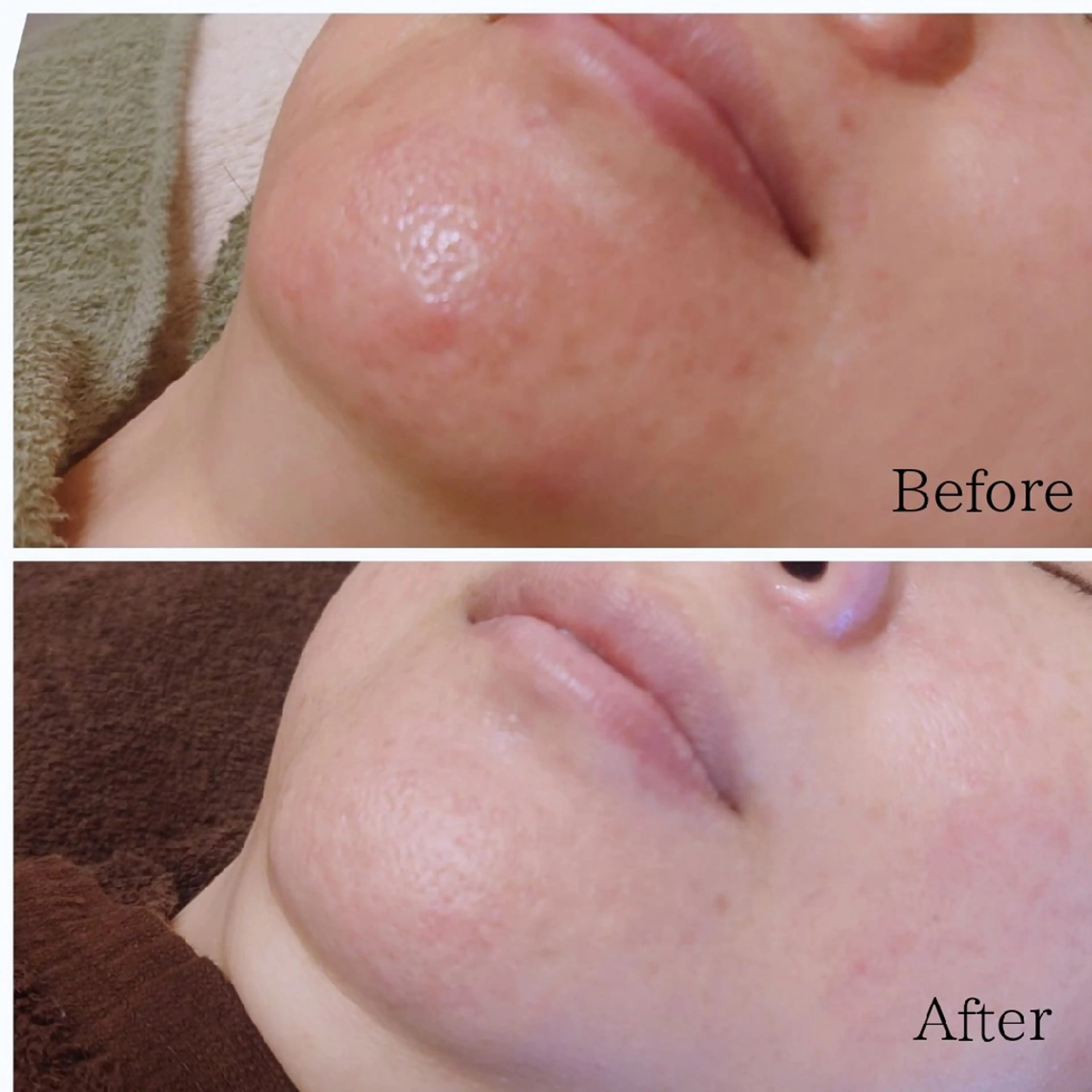 エステ Ellebeauty relaxationのエステ・リラクイメージ