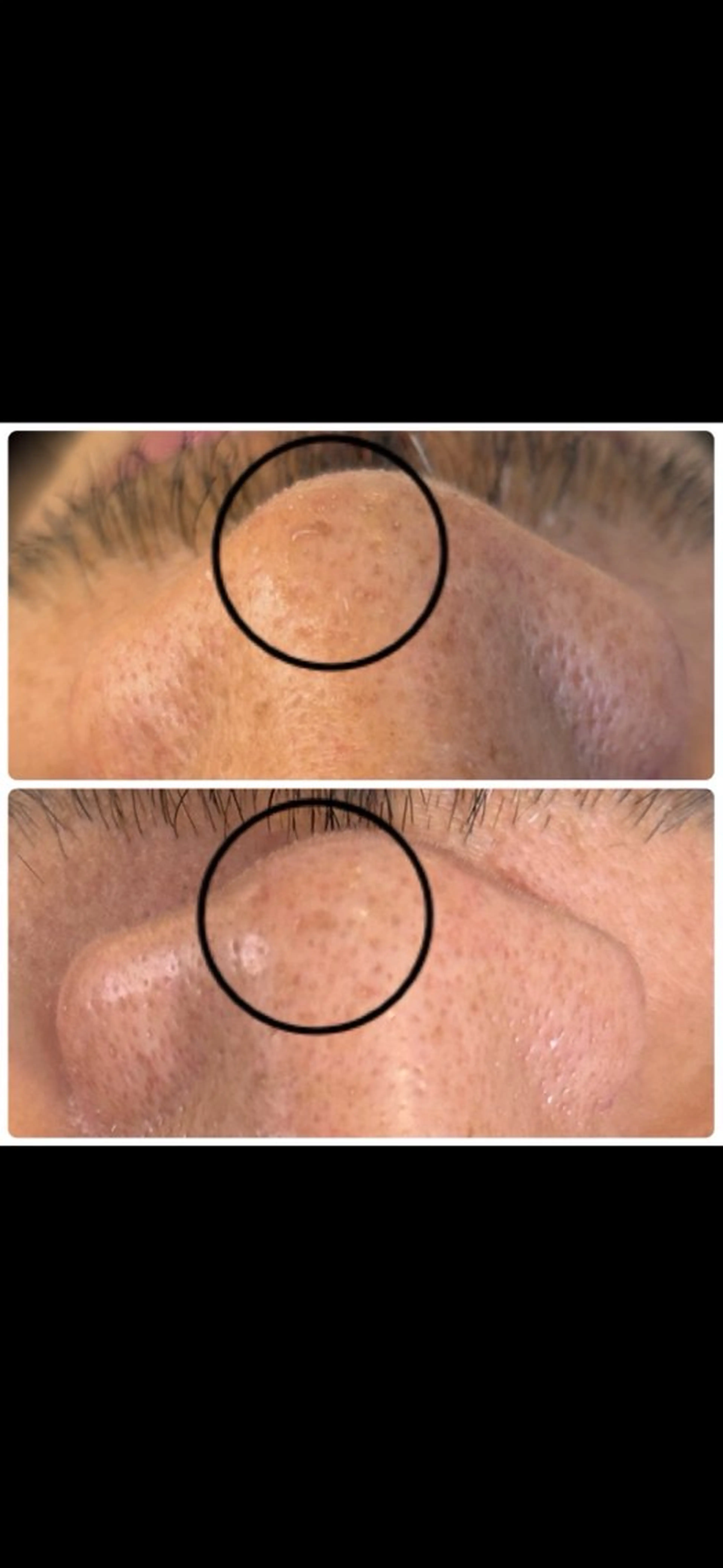 エステ By color  EYE&NAIL所属・BY  COLOR eyedesinのマツエク・マツパデザイン