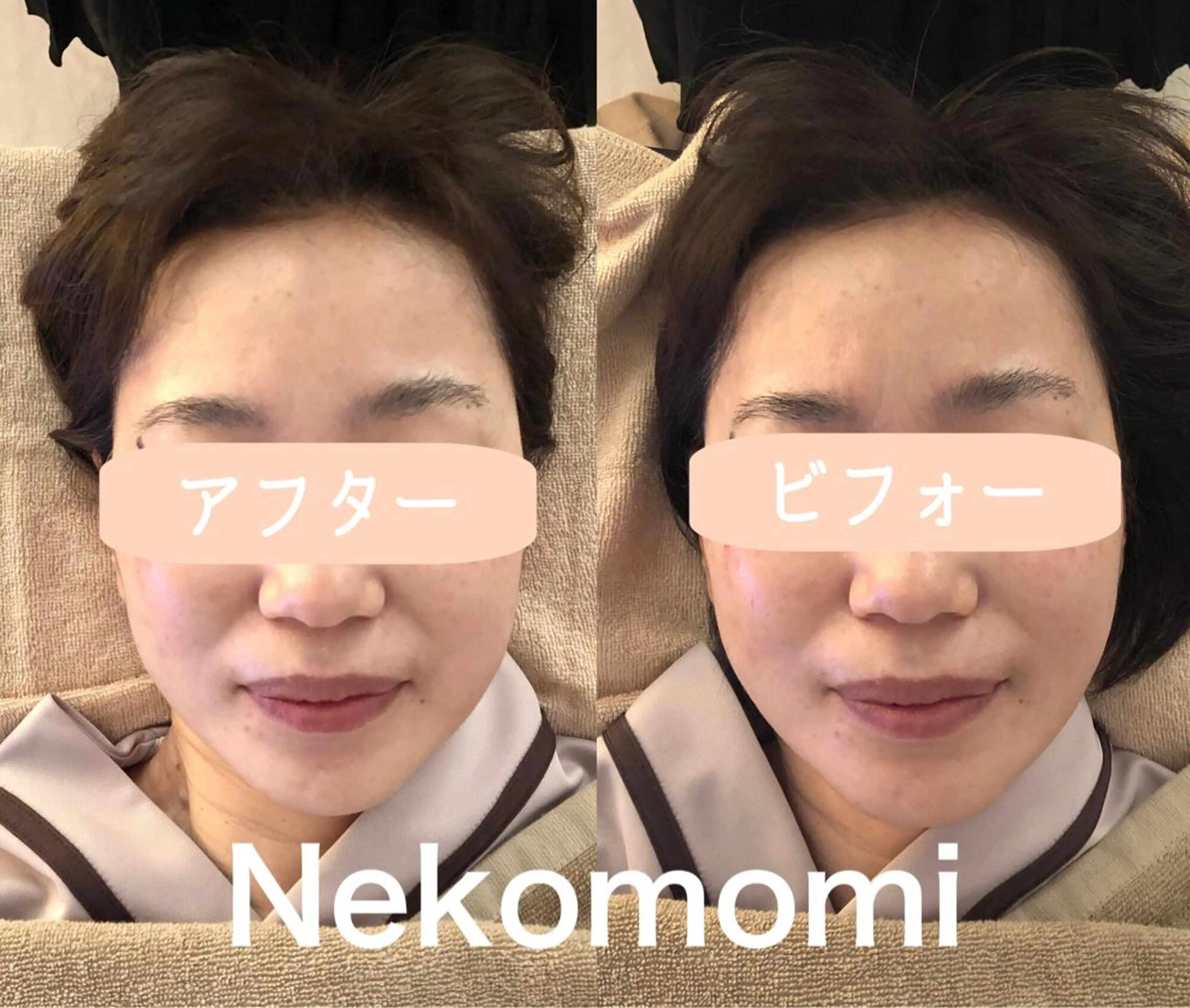 【劇的小顔コルギ＆オイルリンパマッサージ】90分　小顔コルギ➕30分デトックスボディオイルリンパマッサージの写真