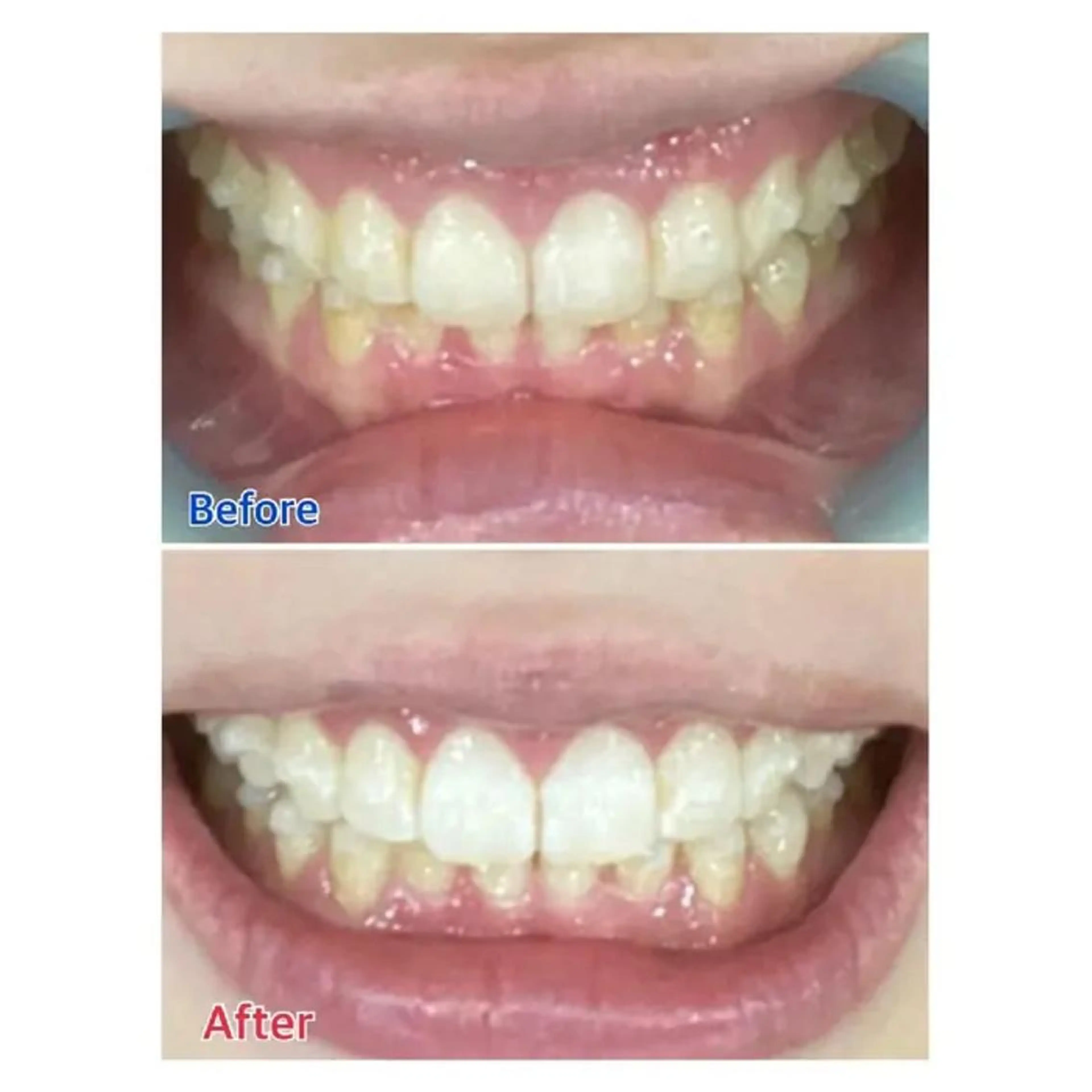 M渋谷 ホワイトニングのエステ・リラクイメージ