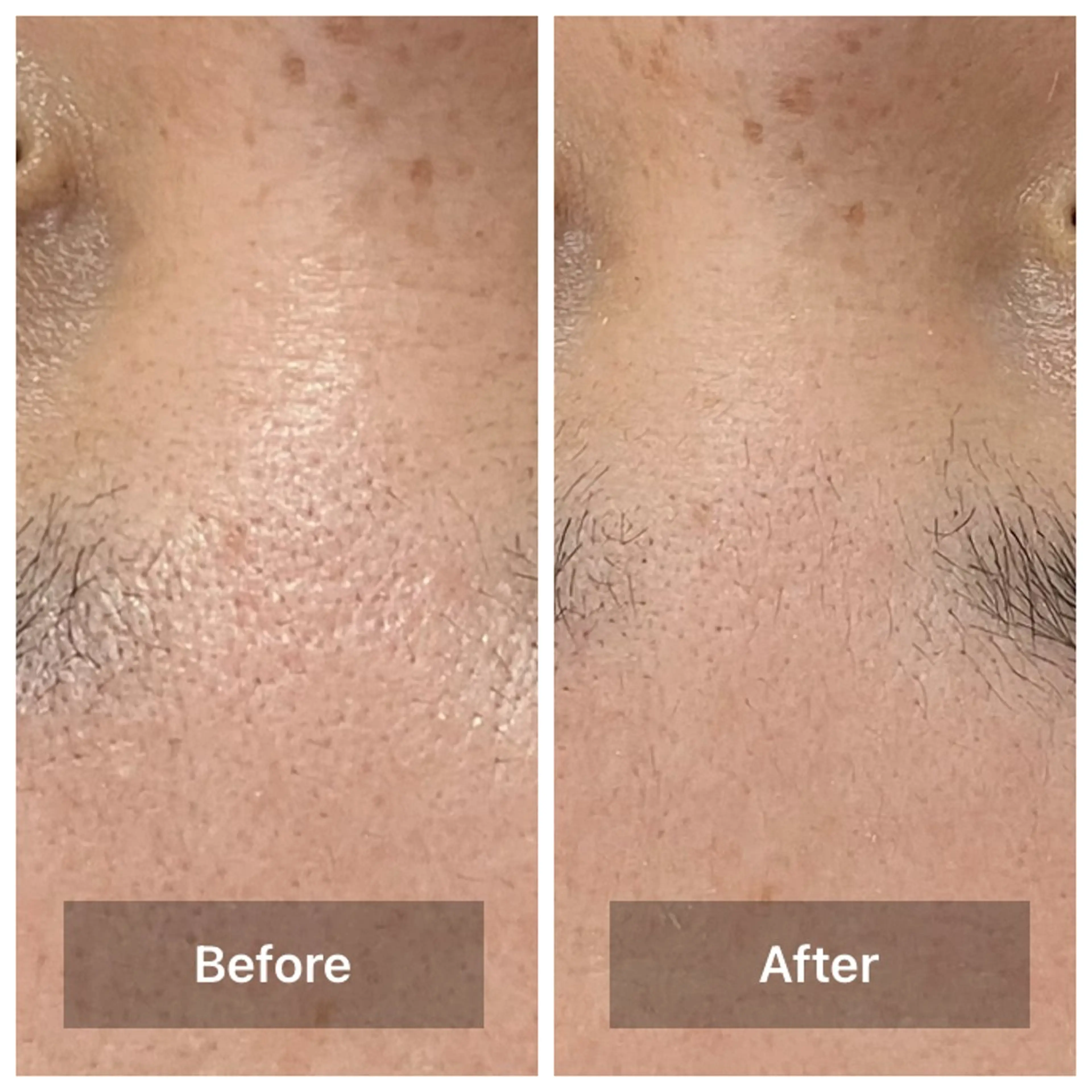 エステ リラク bonuru salonのエステ・リラクイメージ