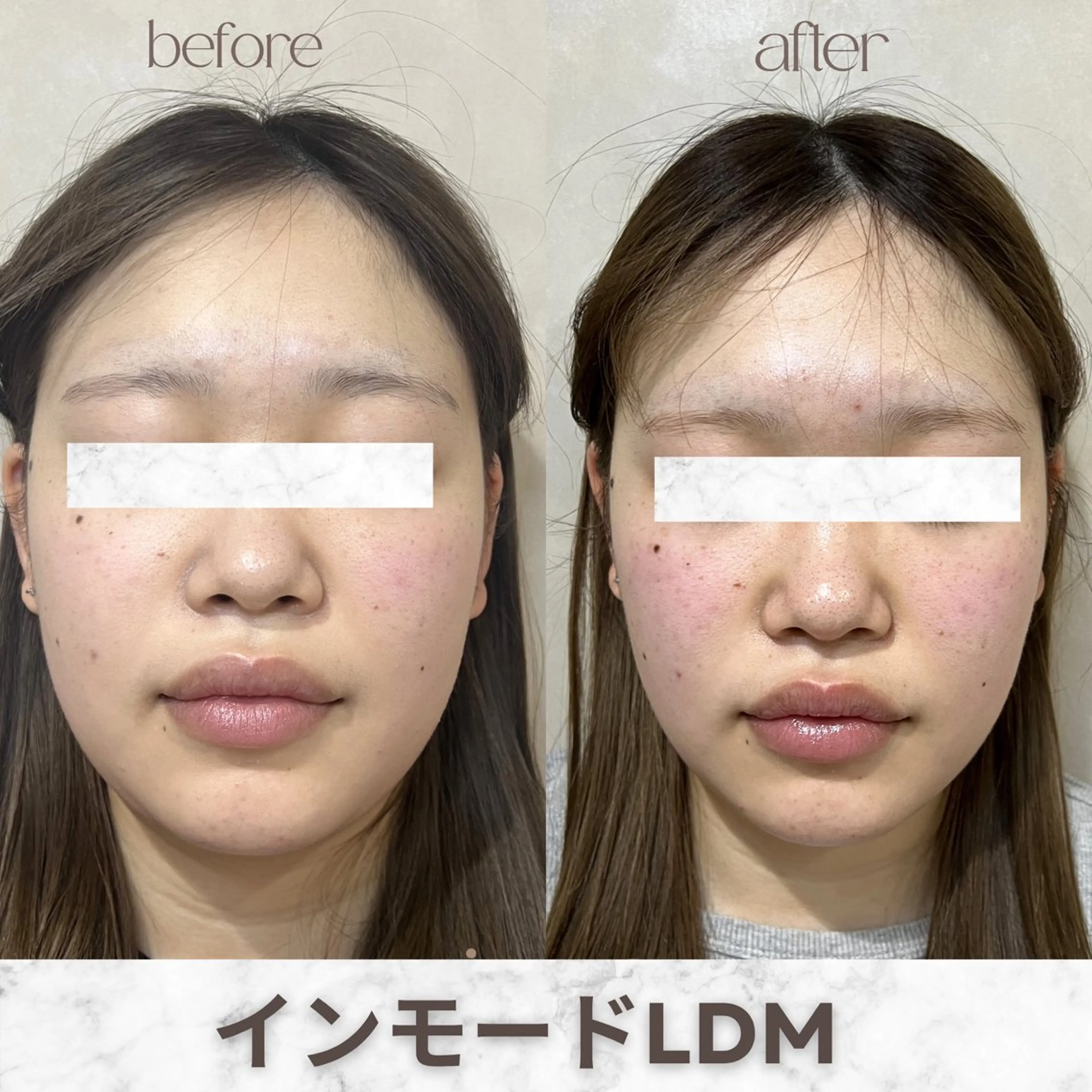 エステ aimer服部 /  小顔 ・ 痩身のその他イメージ