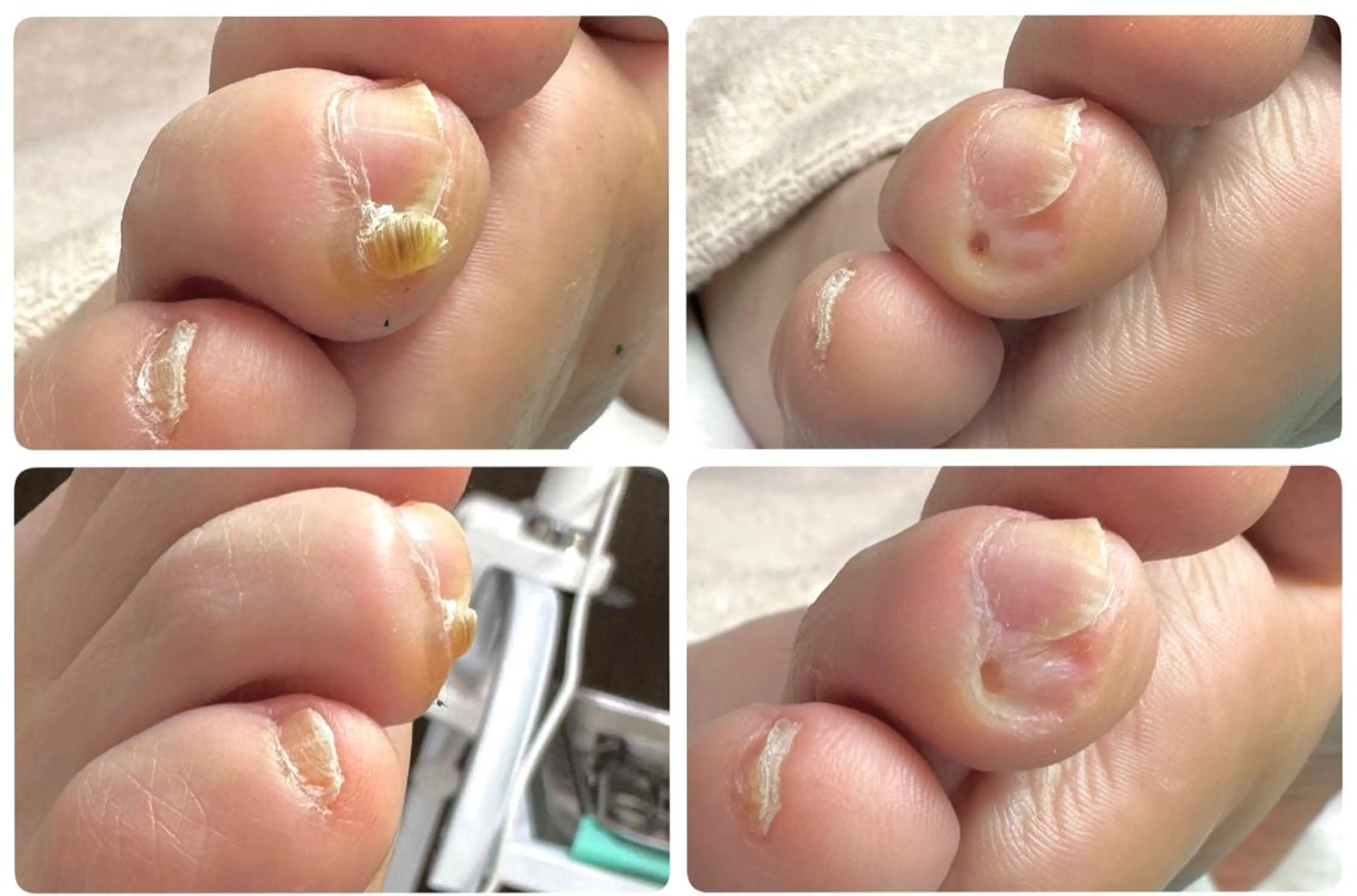 東京巻き爪 アカデミーのエステ・リラクイメージ