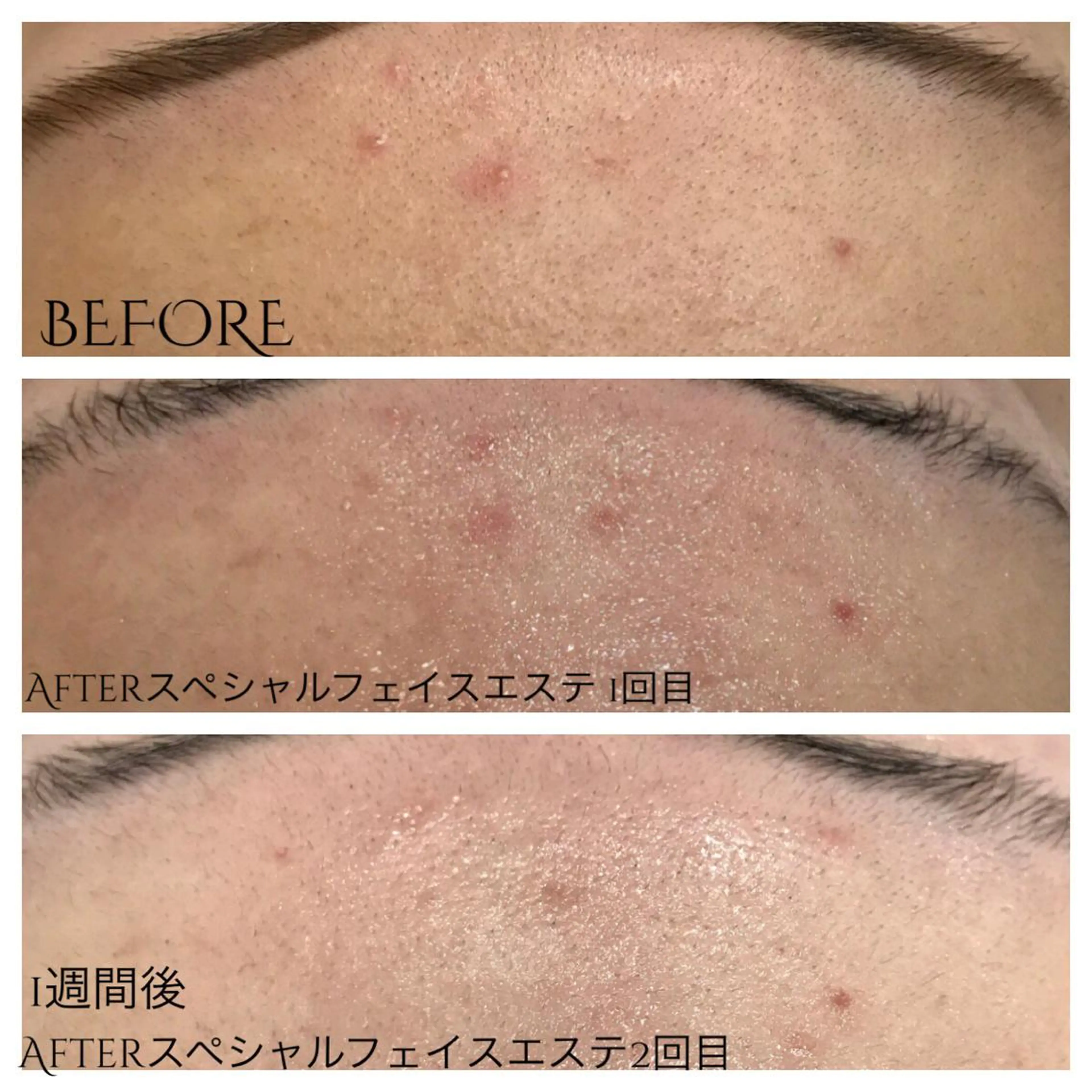 ビューティー ミロワールのエステ・リラクイメージ