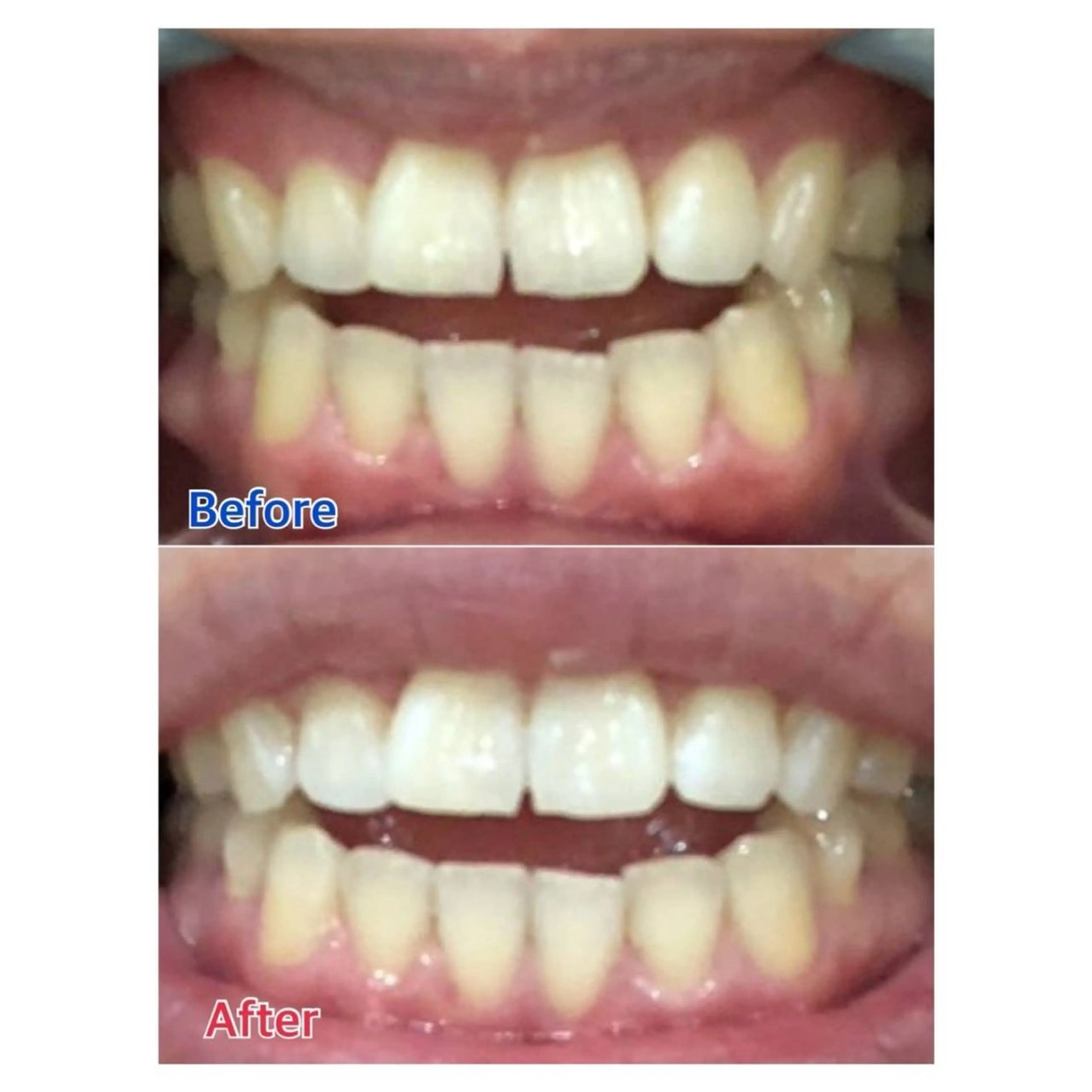 Melty 輝のその他イメージ