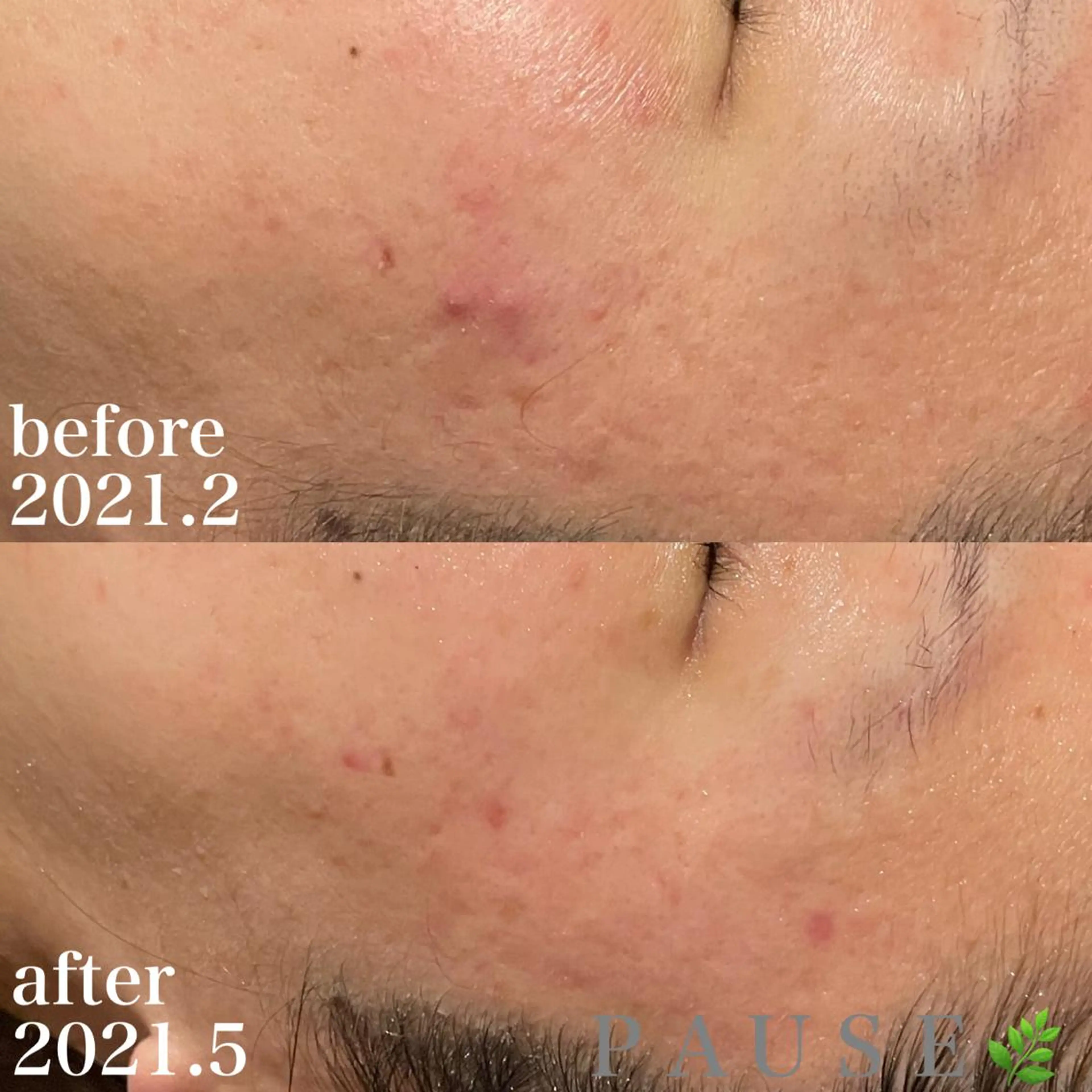 エステ 浜野 恵美のエステ・リラクイメージ