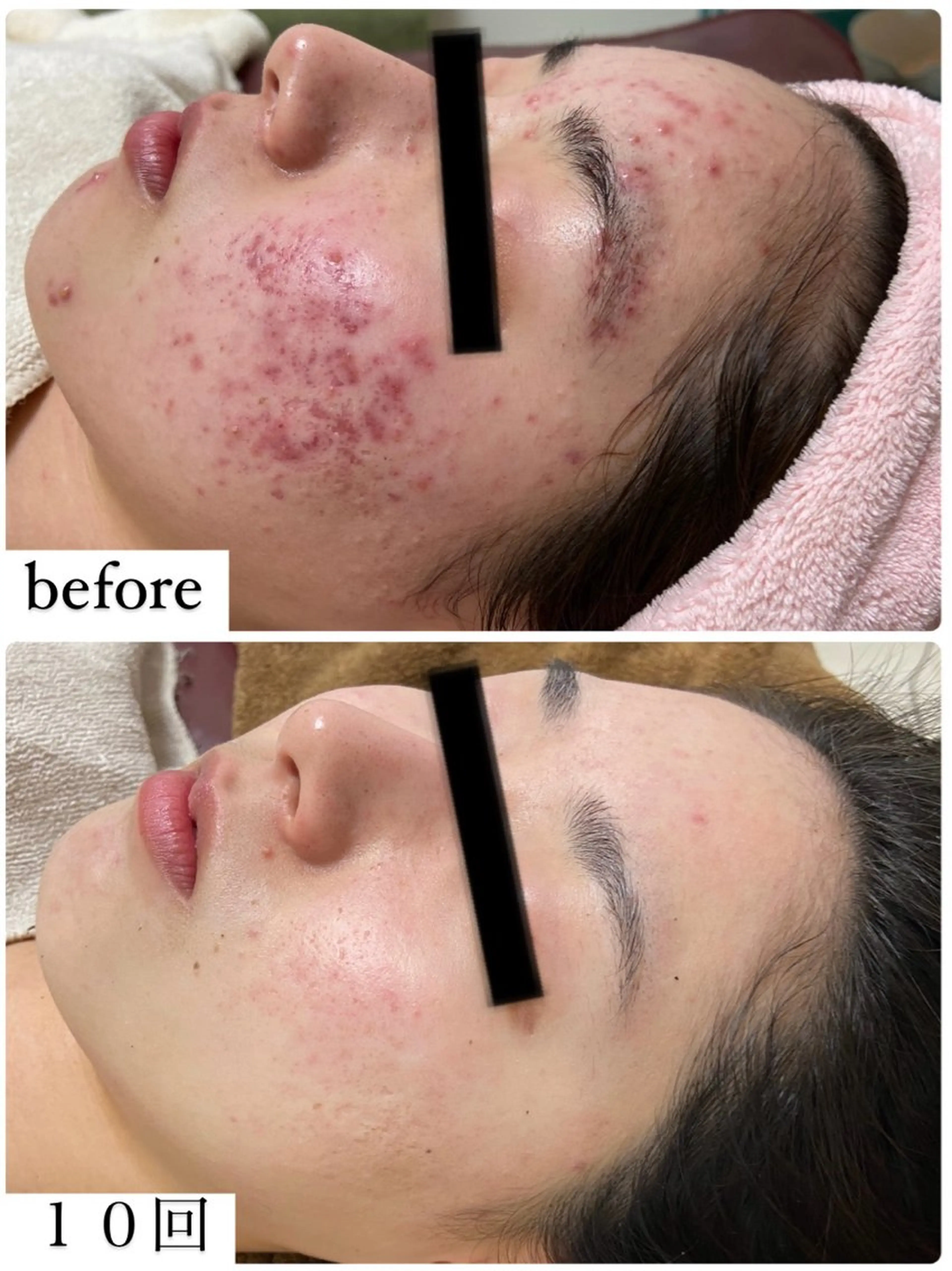 エステ REBORN by ami-goのその他イメージ