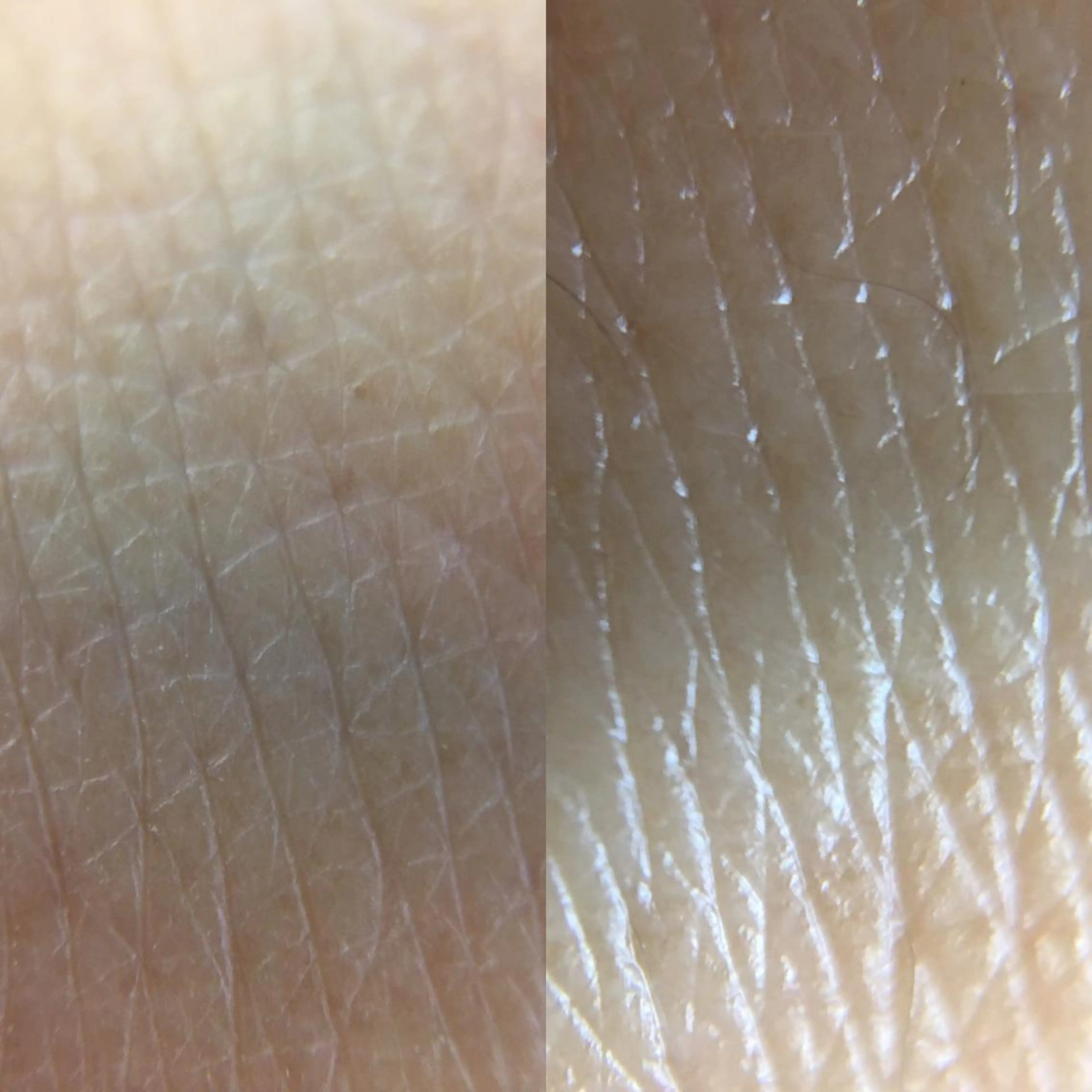 🏳️‍🌈 CHIYAKAのエステ・リラクイメージ