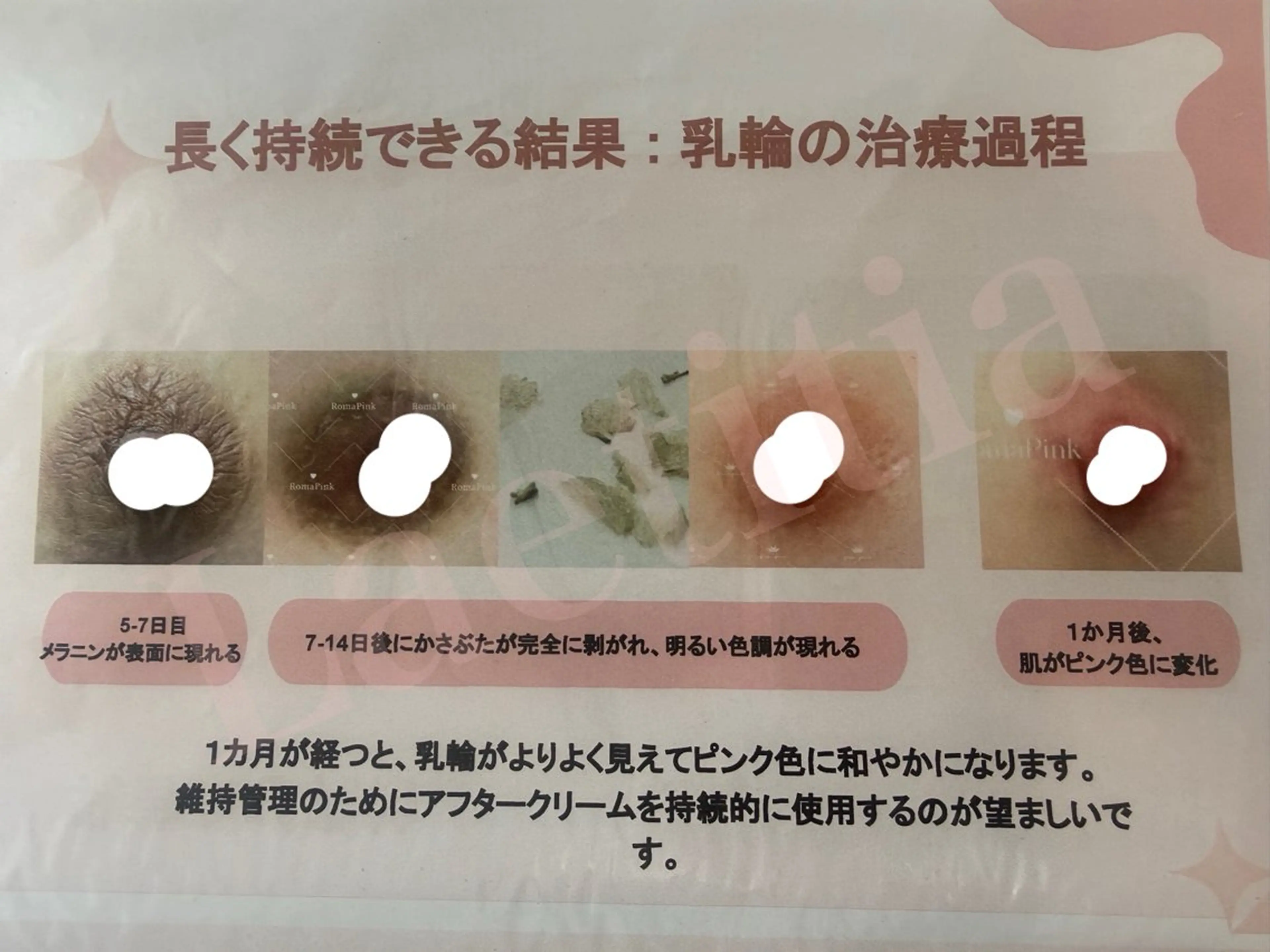 エステ レティティア秋葉原店 Yoshizawaのエステ・リラクイメージ