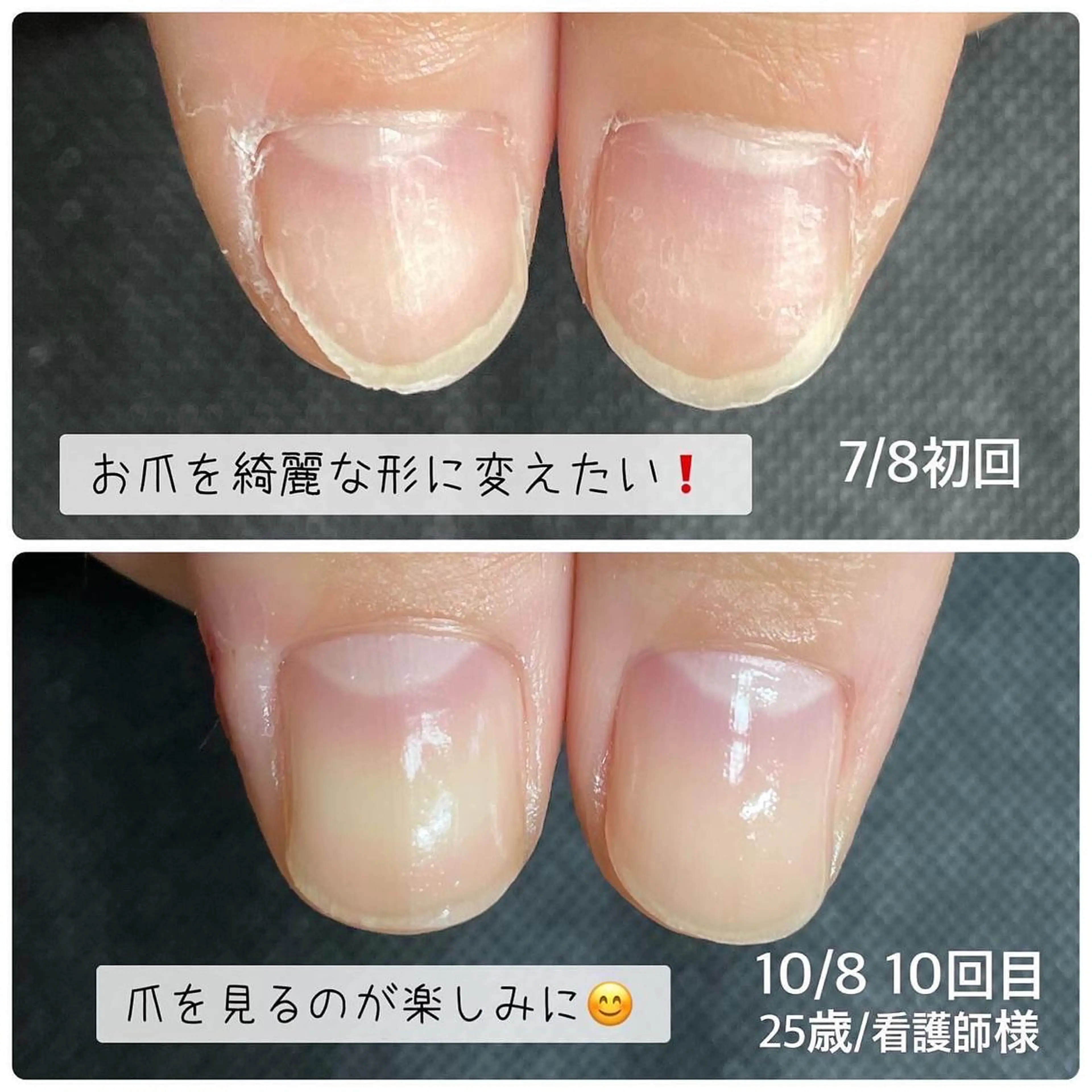 ネイル 奥園 良恵のネイルデザイン