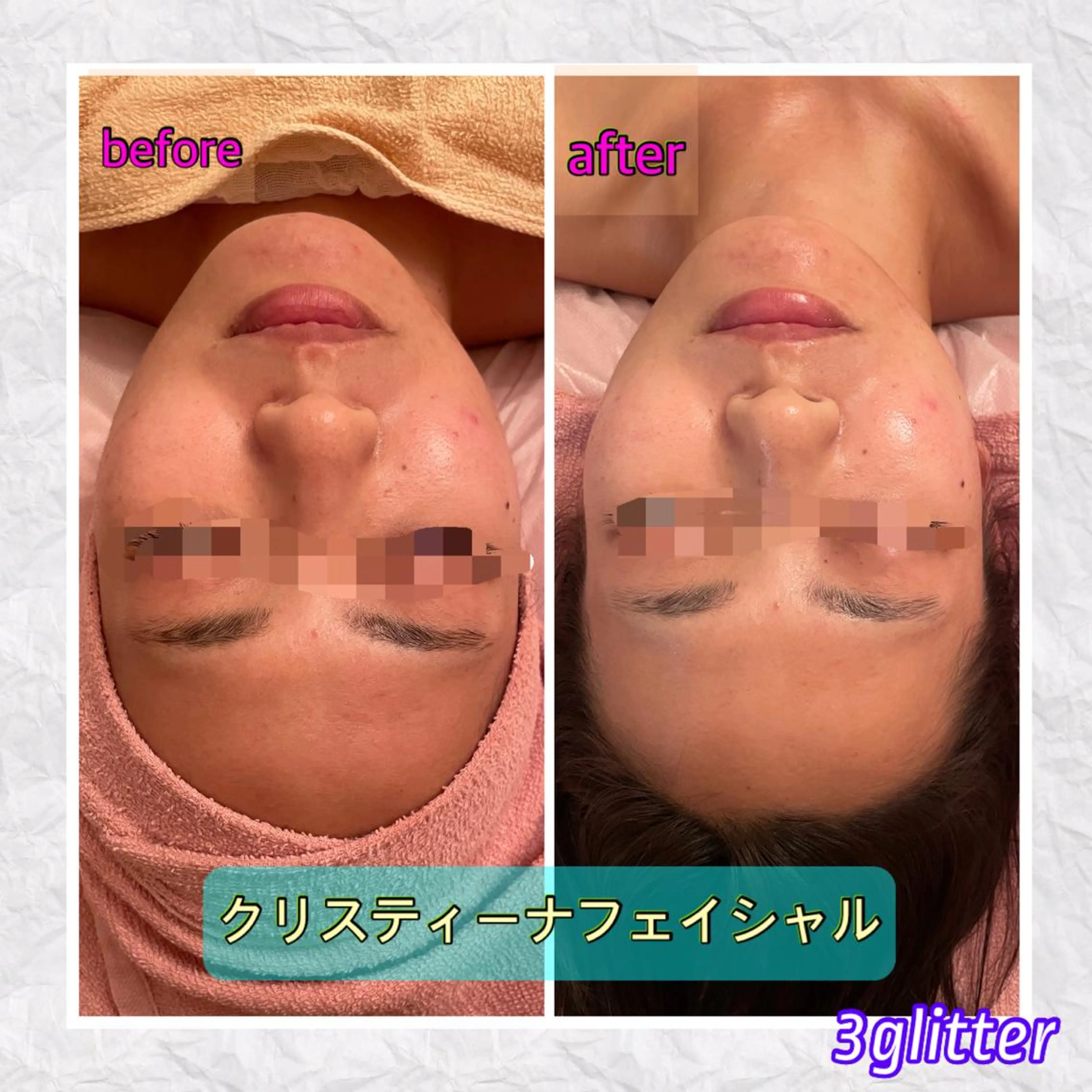 3glitter 肌質改善＆痩身のエステ・リラクイメージ