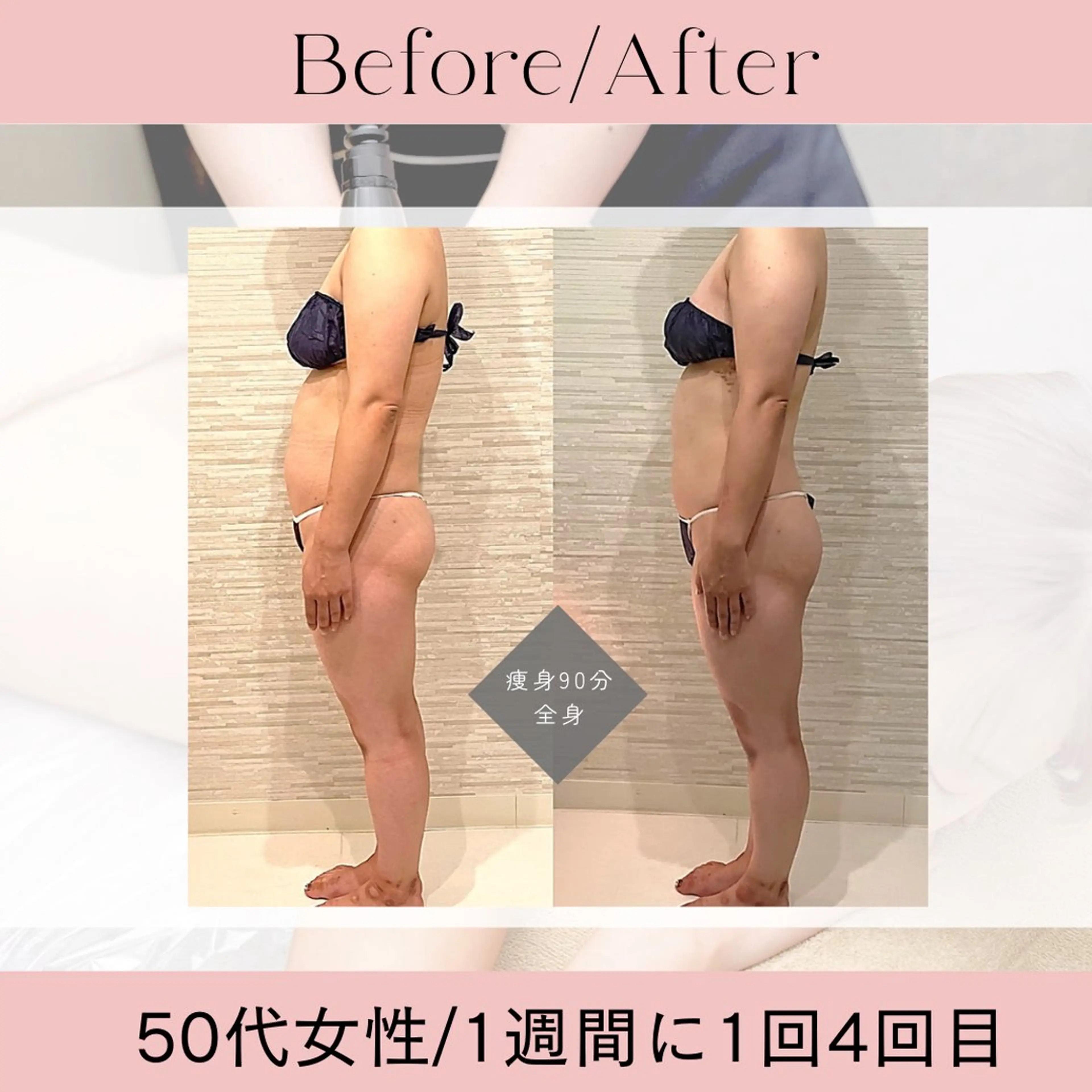 エステ リラク 痩身＆小顔サロン EXTREMITYのエステ・リラクイメージ