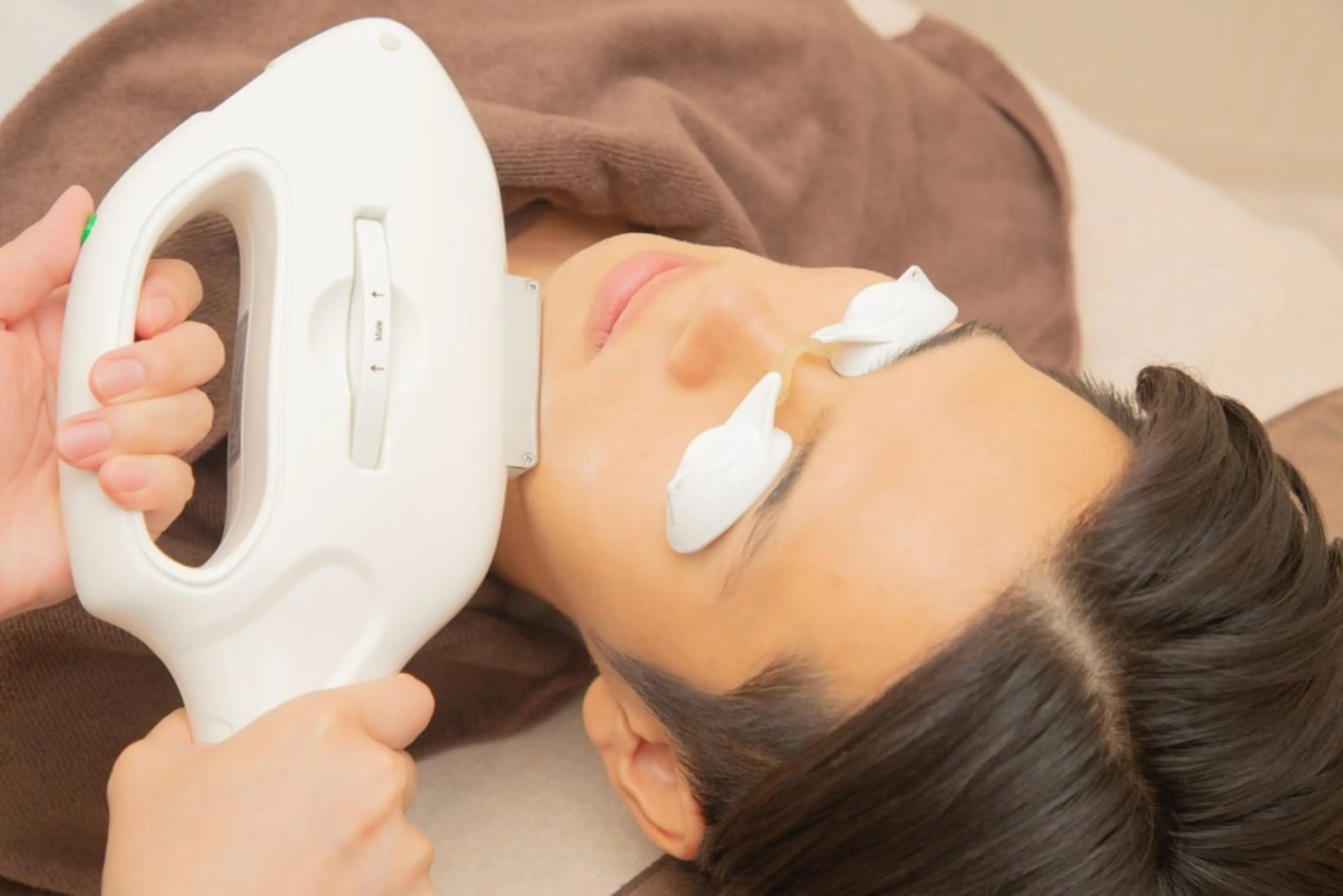 男性ヒゲ脱毛【全体】カミソリ負け＆青ヒゲから卒業✨通常5500円→3300円の写真