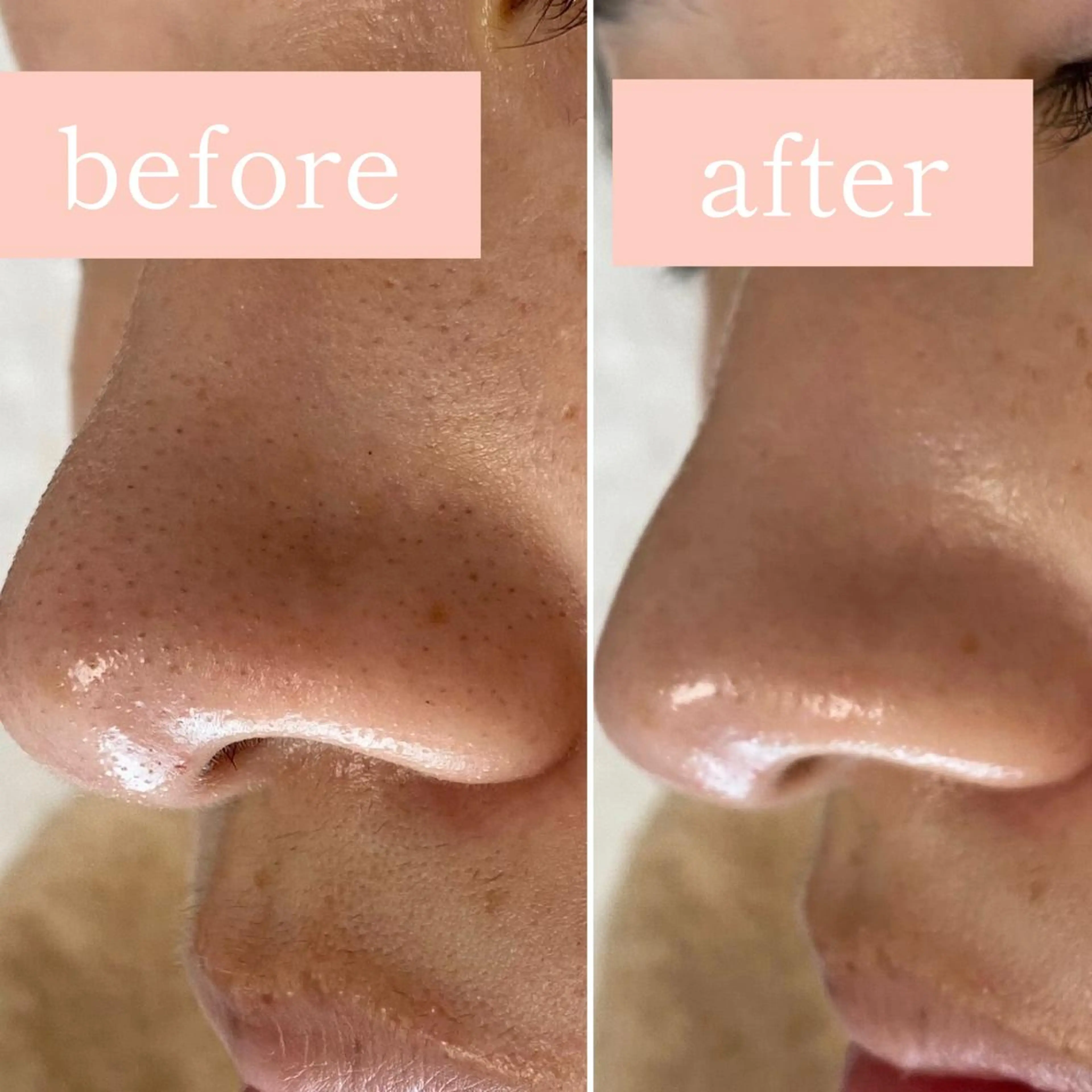 毛穴専門サロン　フルール所属・フルールFululu 自由が丘のエステ・リラクイメージ