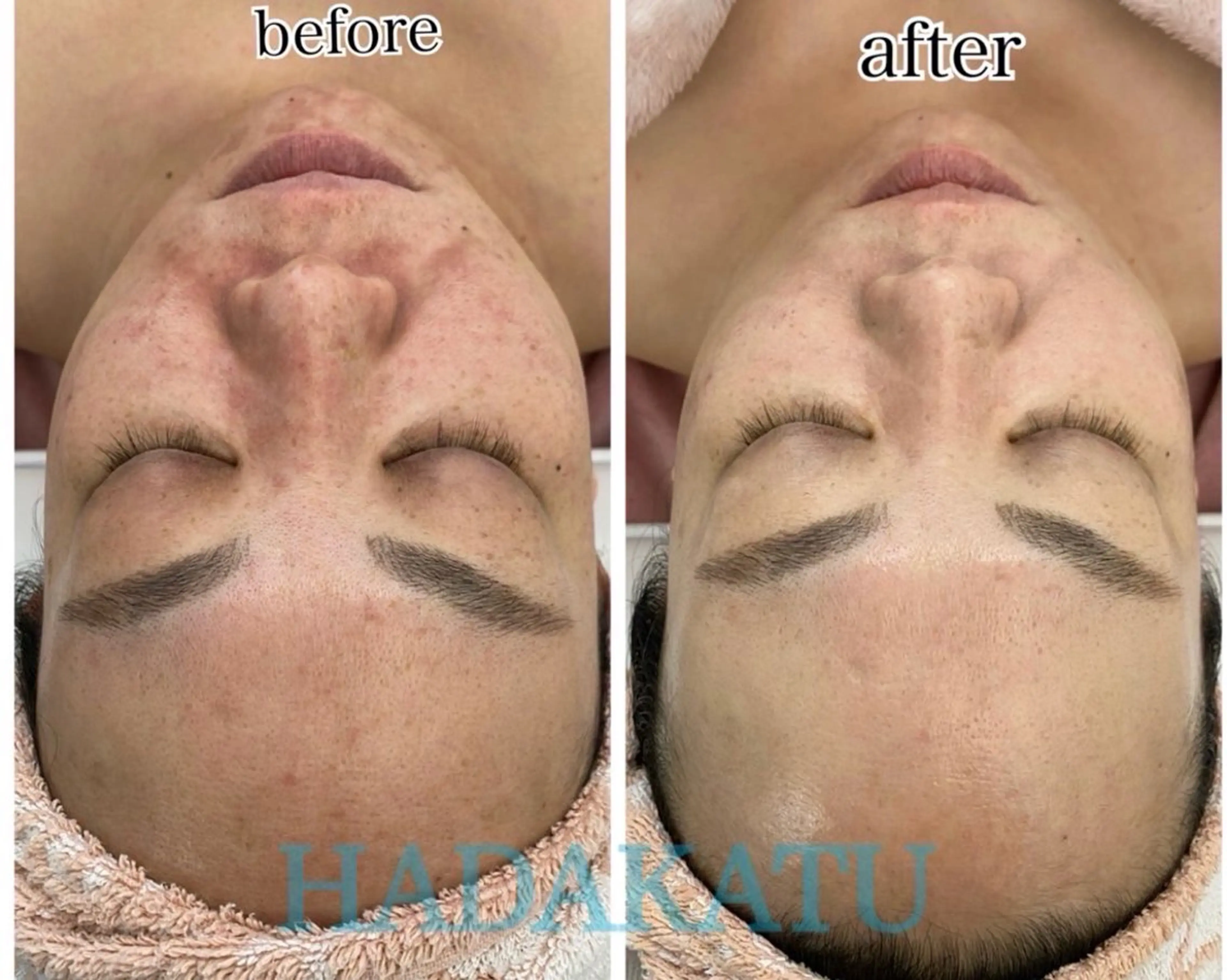 エステ 総合エステサロン 肌活のエステ・リラクイメージ